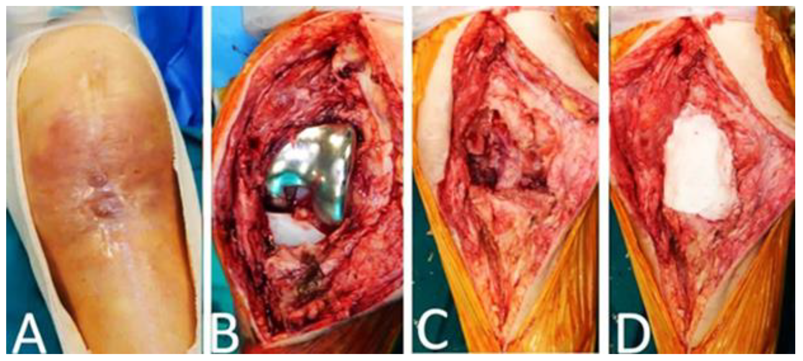 Jcm 12 03600 g004 Jcm 12 03600 g004