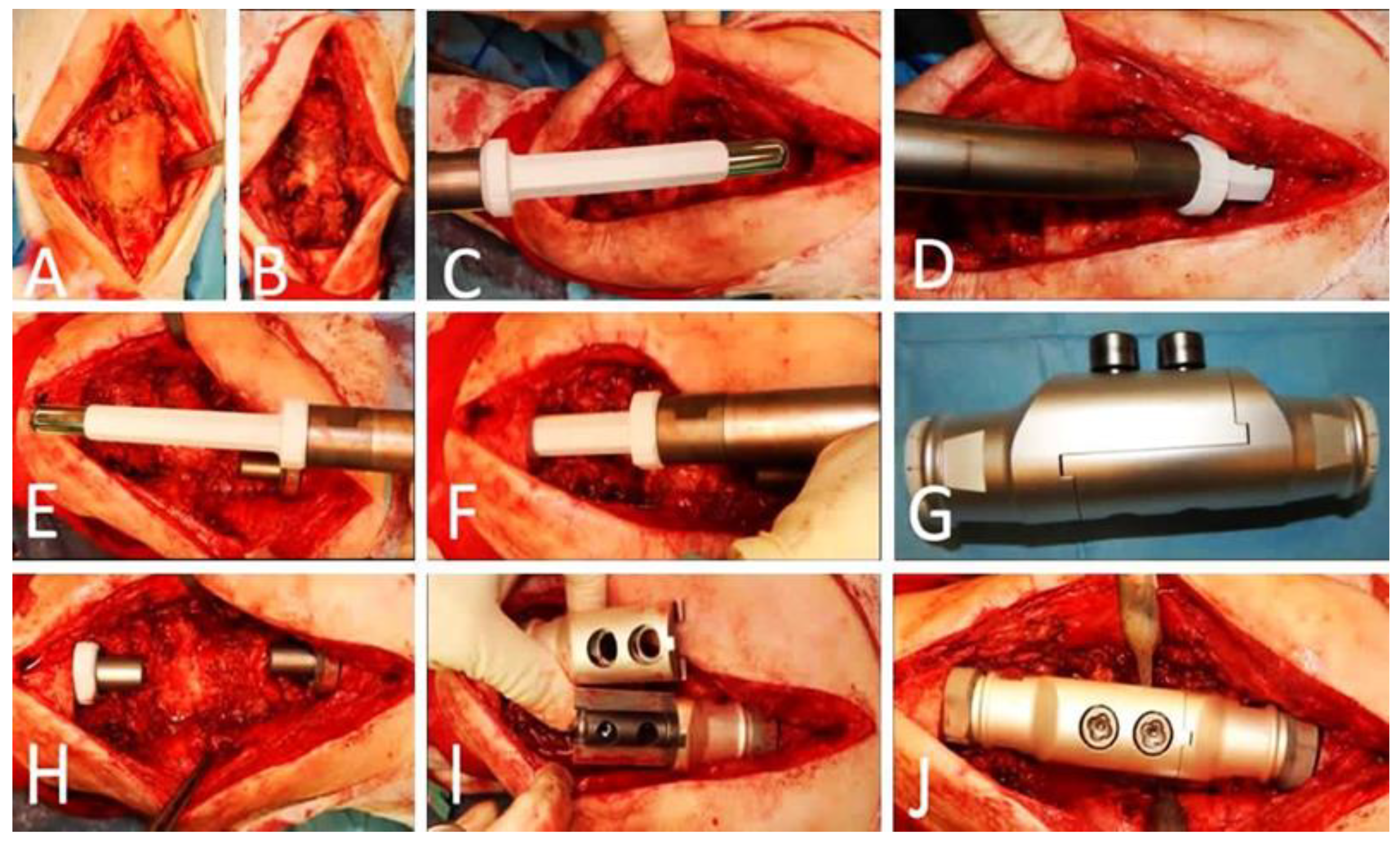 Jcm 12 03600 g005 Jcm 12 03600 g005