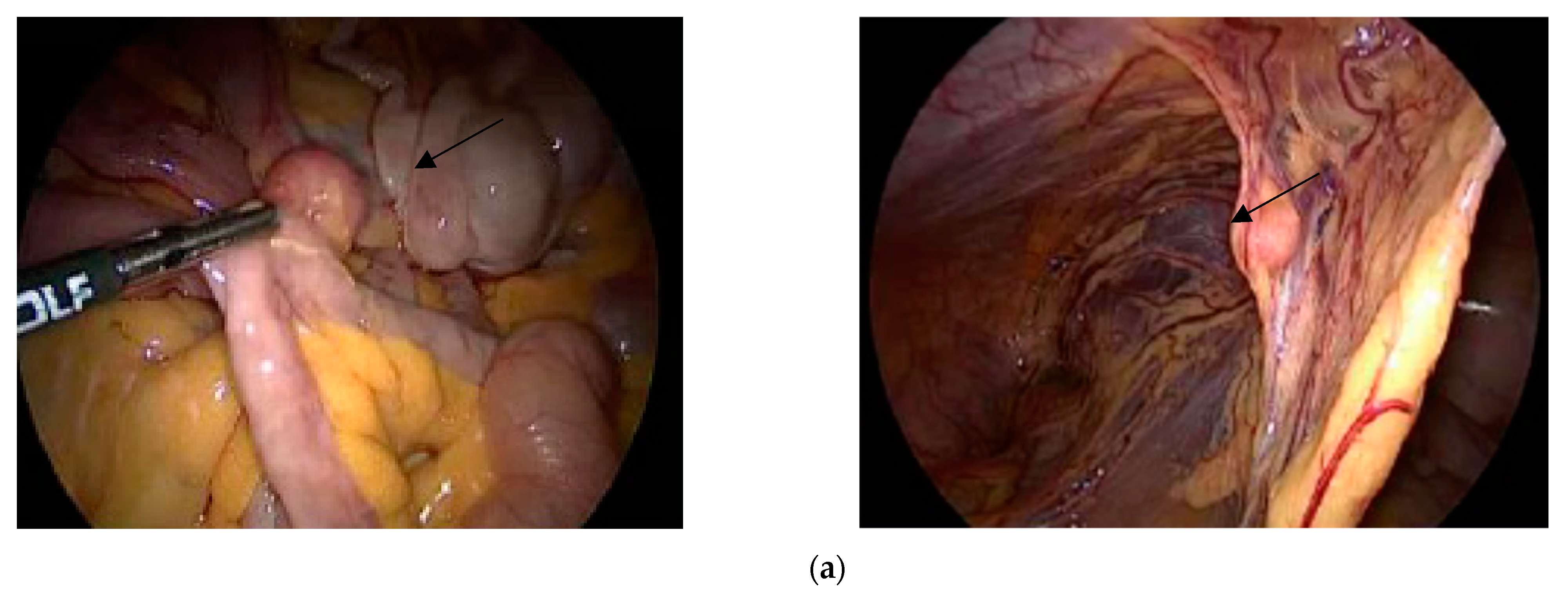 Jcm 12 03628 g002a Jcm 12 03628 g002a
