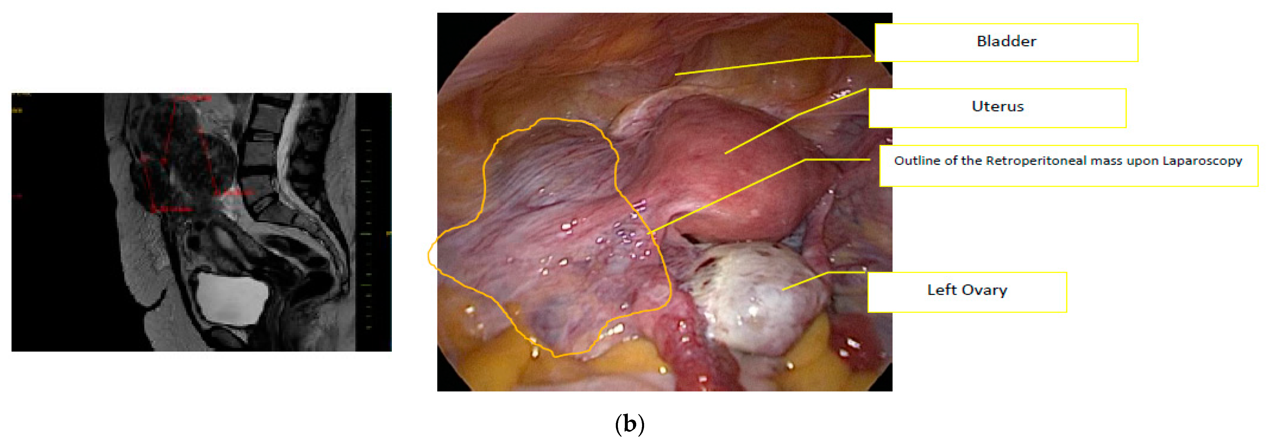 Jcm 12 03628 g002b Jcm 12 03628 g002b