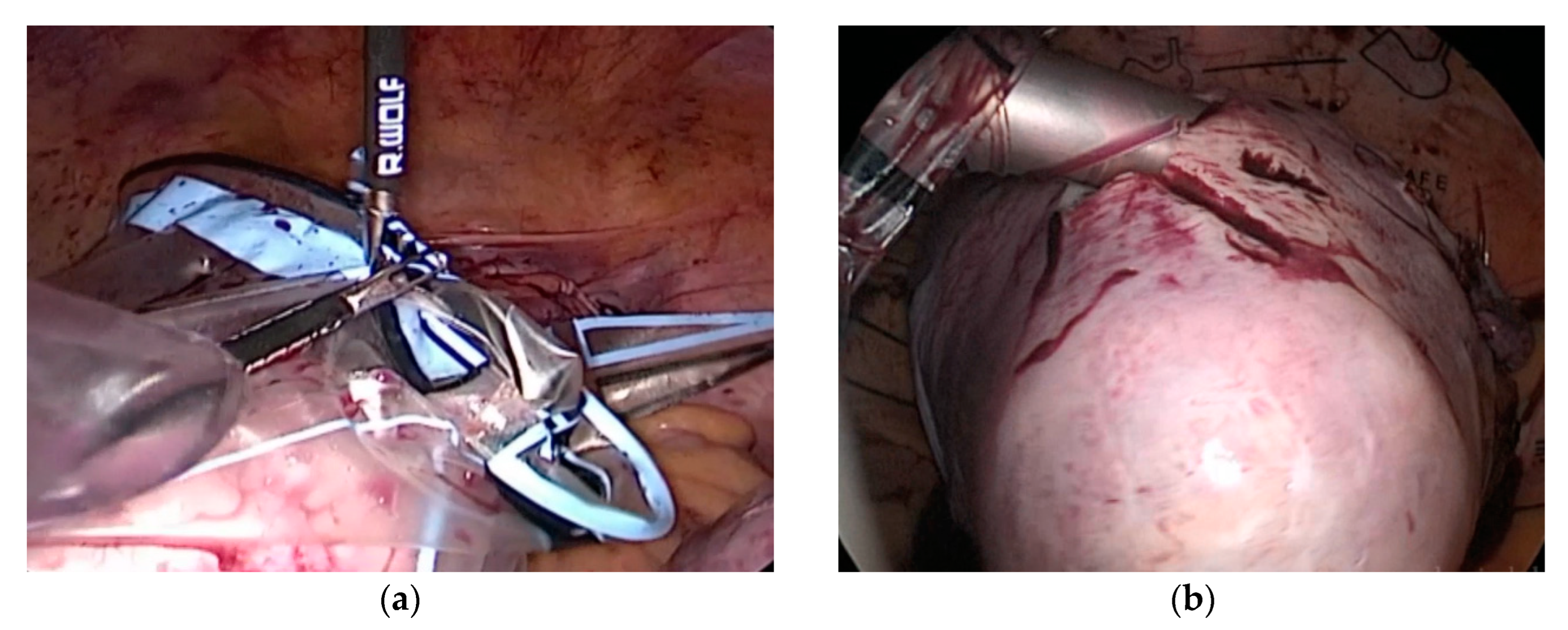 Jcm 12 03628 g003 Jcm 12 03628 g003