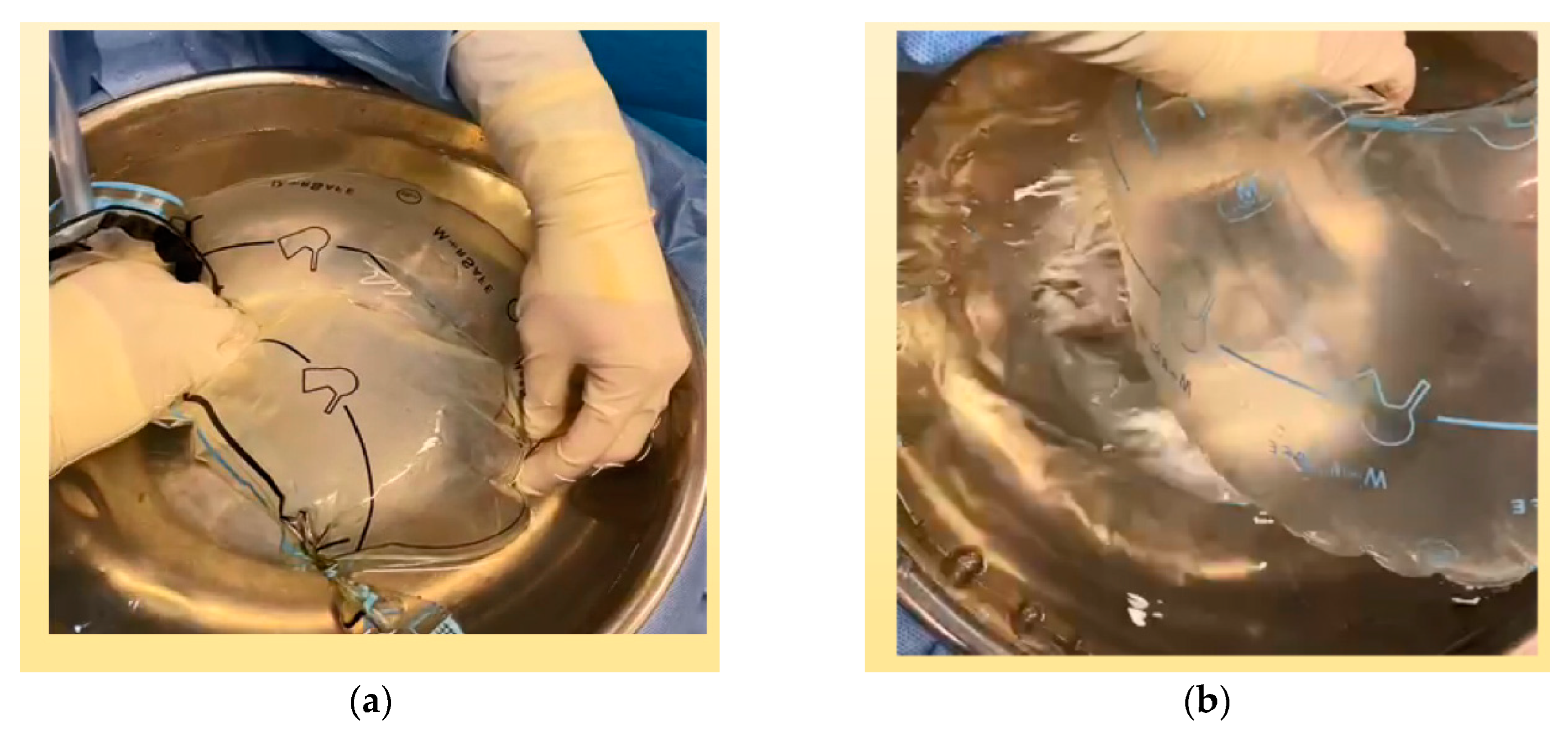 Jcm 12 03628 g004 Jcm 12 03628 g004