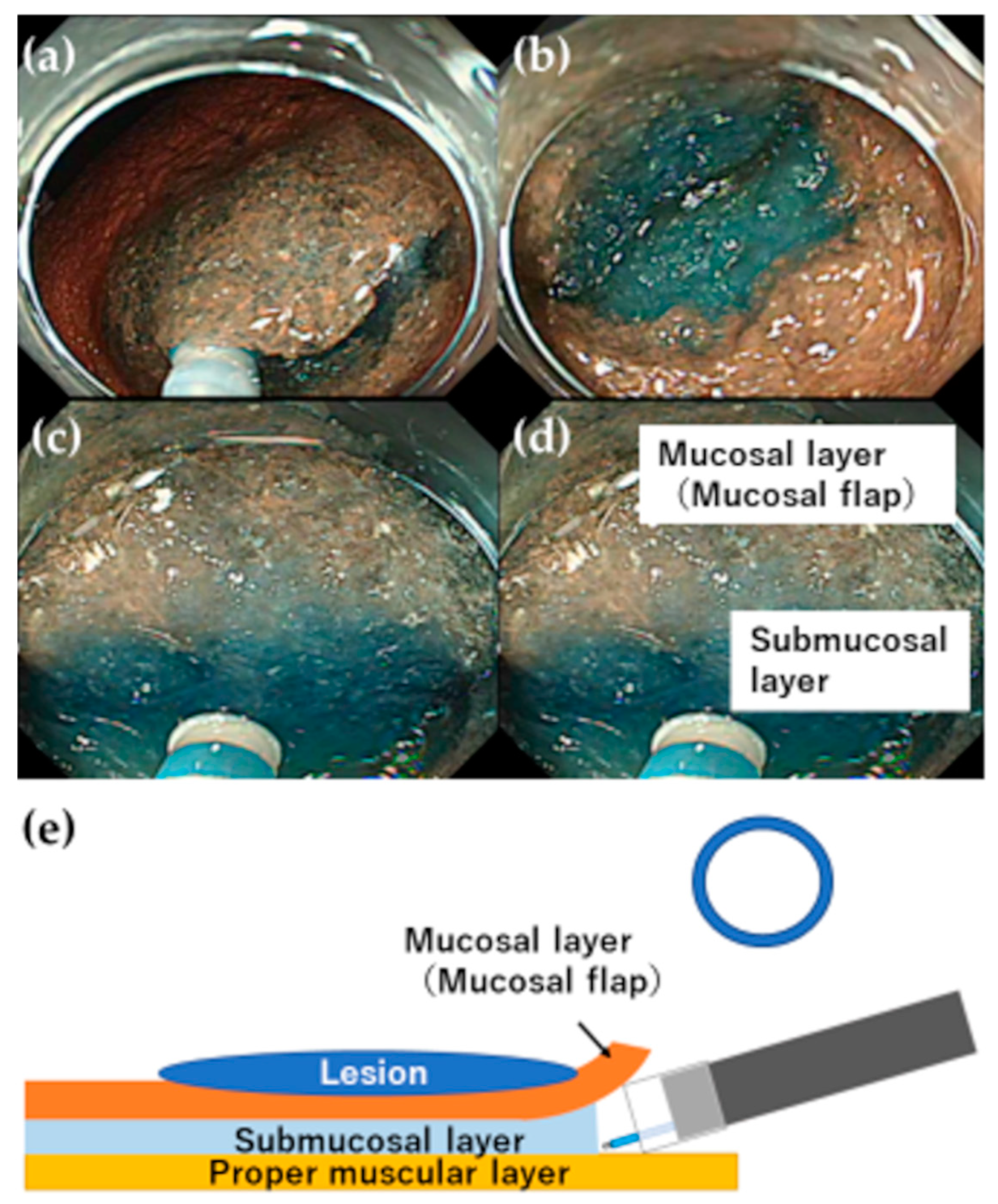Jcm 12 03692 g003 Jcm 12 03692 g003