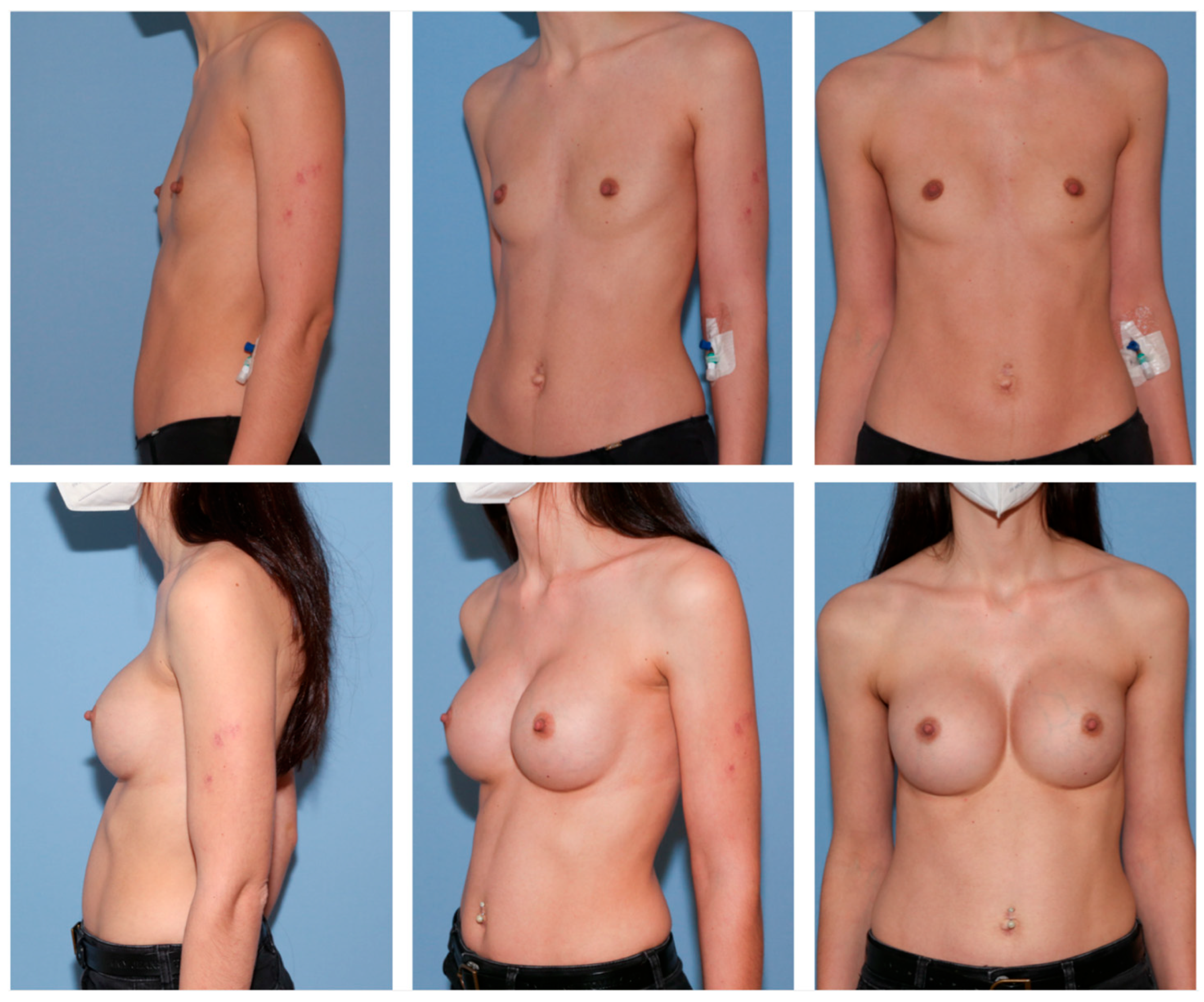 Jcm 12 03708 g003 Jcm 12 03708 g003