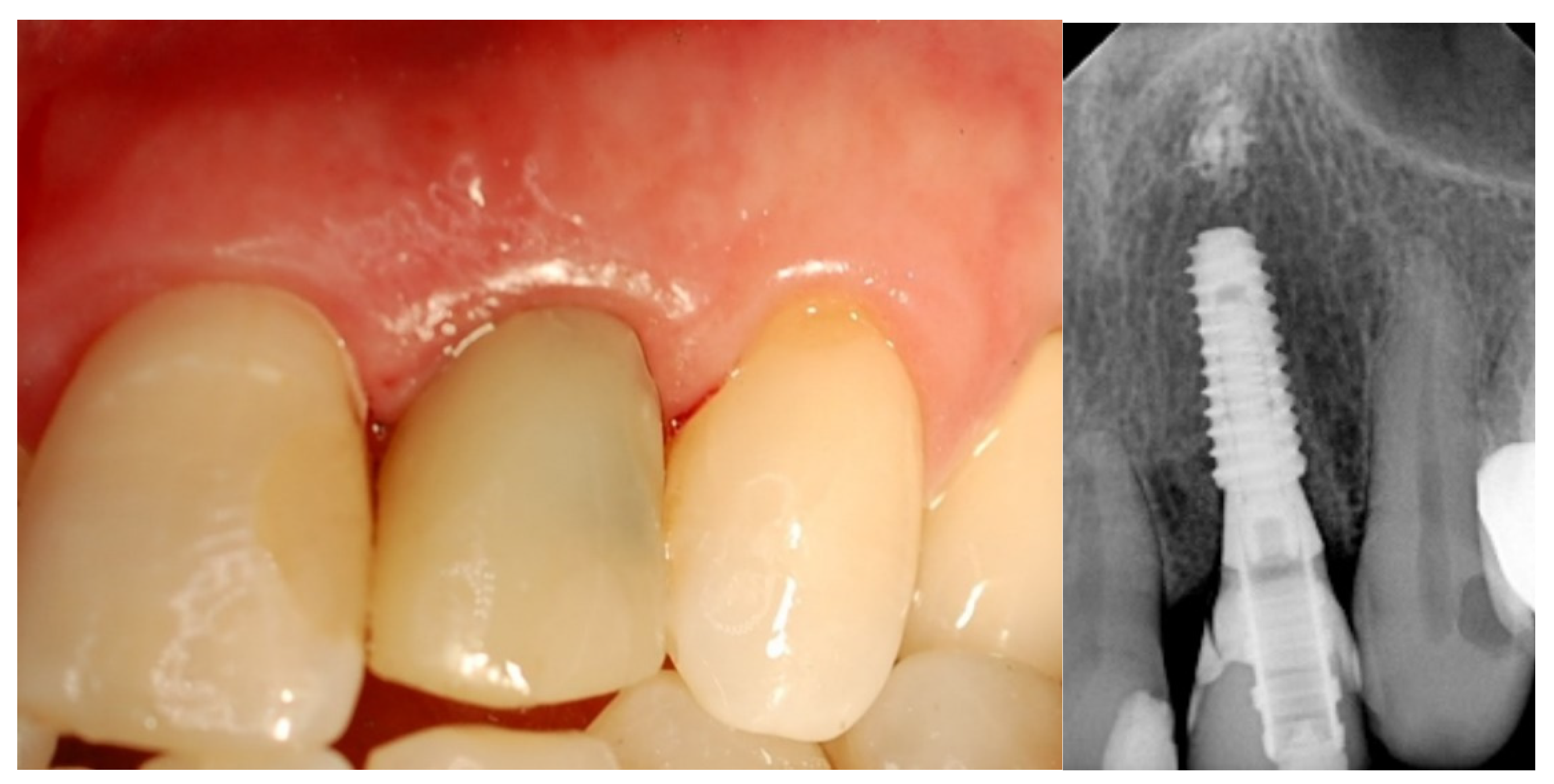 Jcm 12 03711 g003