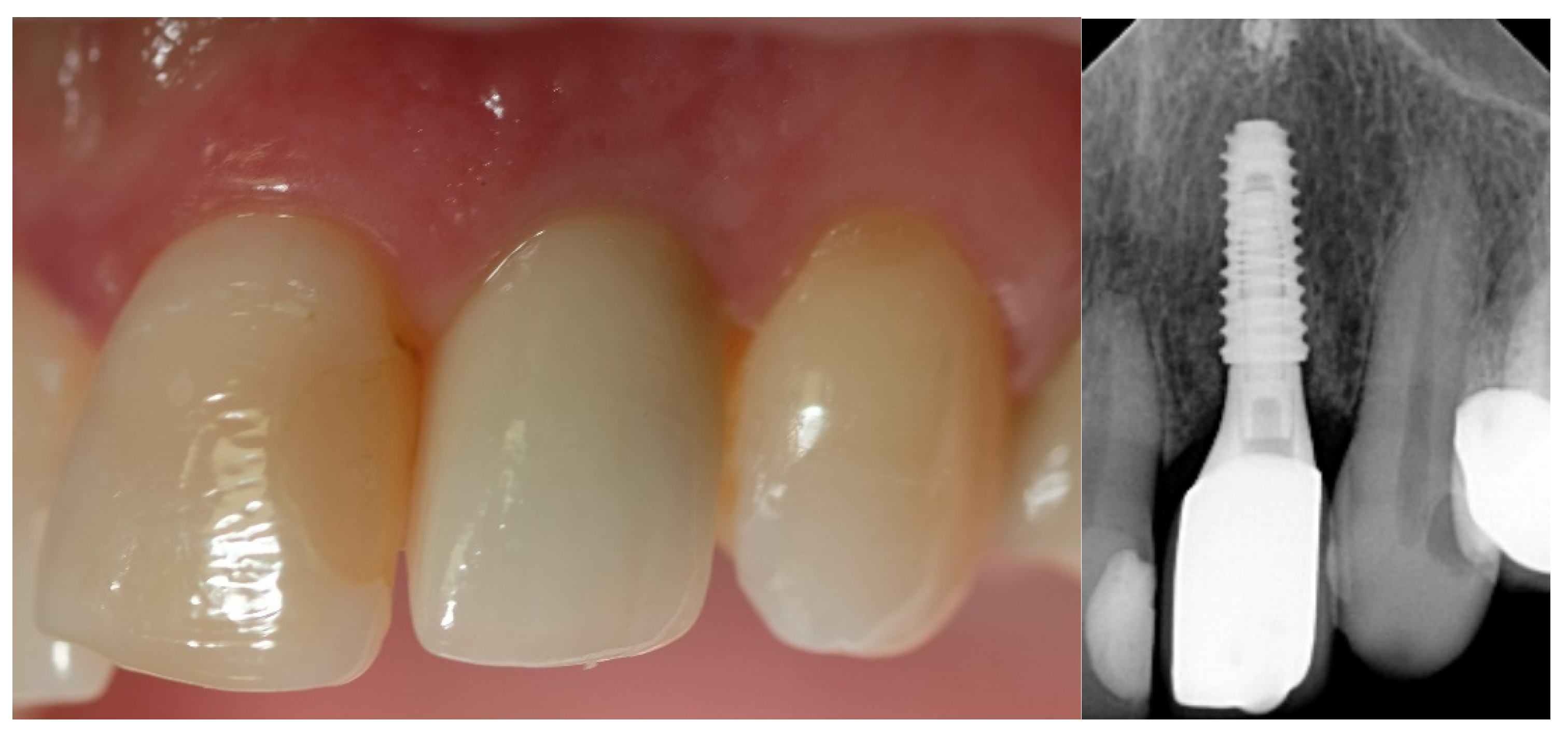 Jcm 12 03711 g004