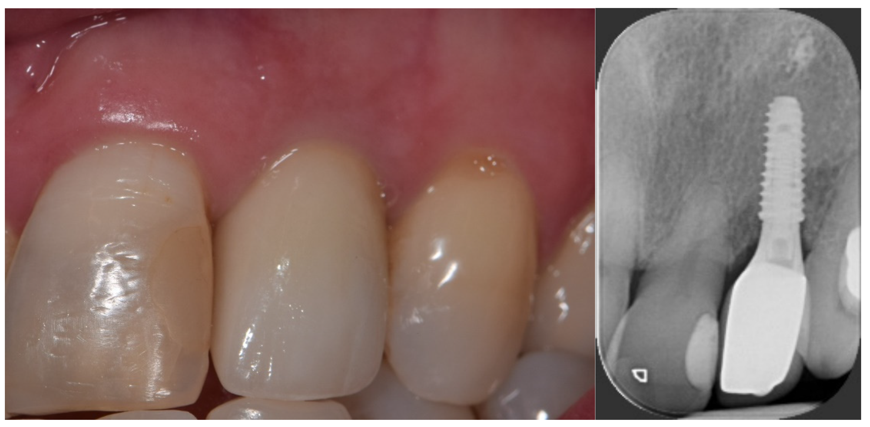 Jcm 12 03711 g005
