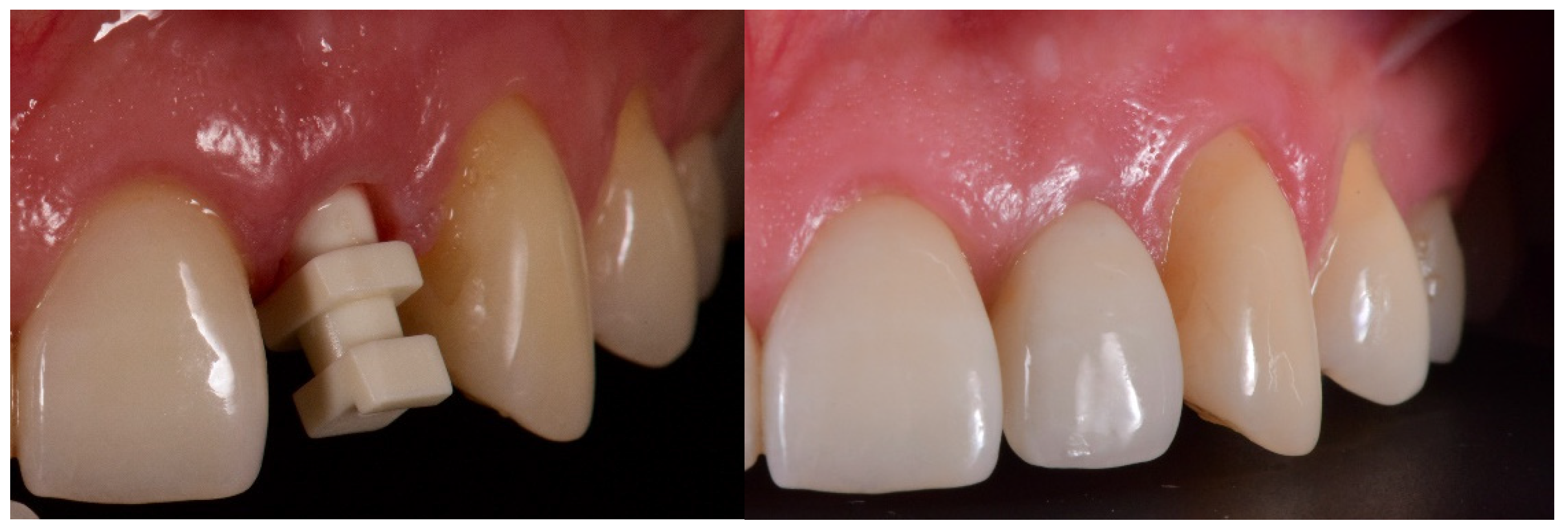 Jcm 12 03711 g008