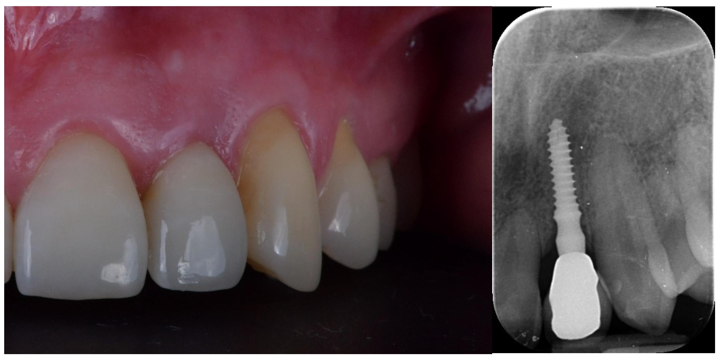 Jcm 12 03711 g009