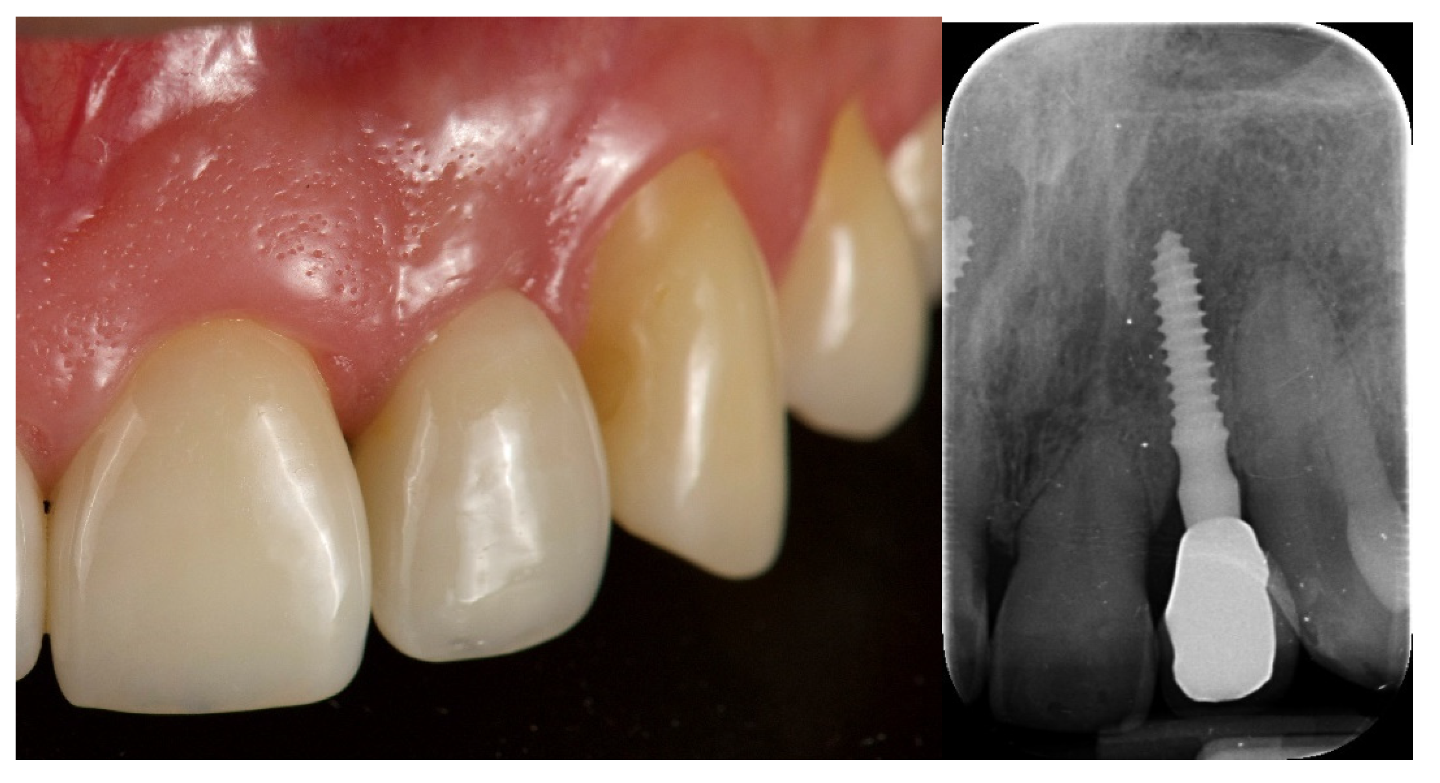 Jcm 12 03711 g010