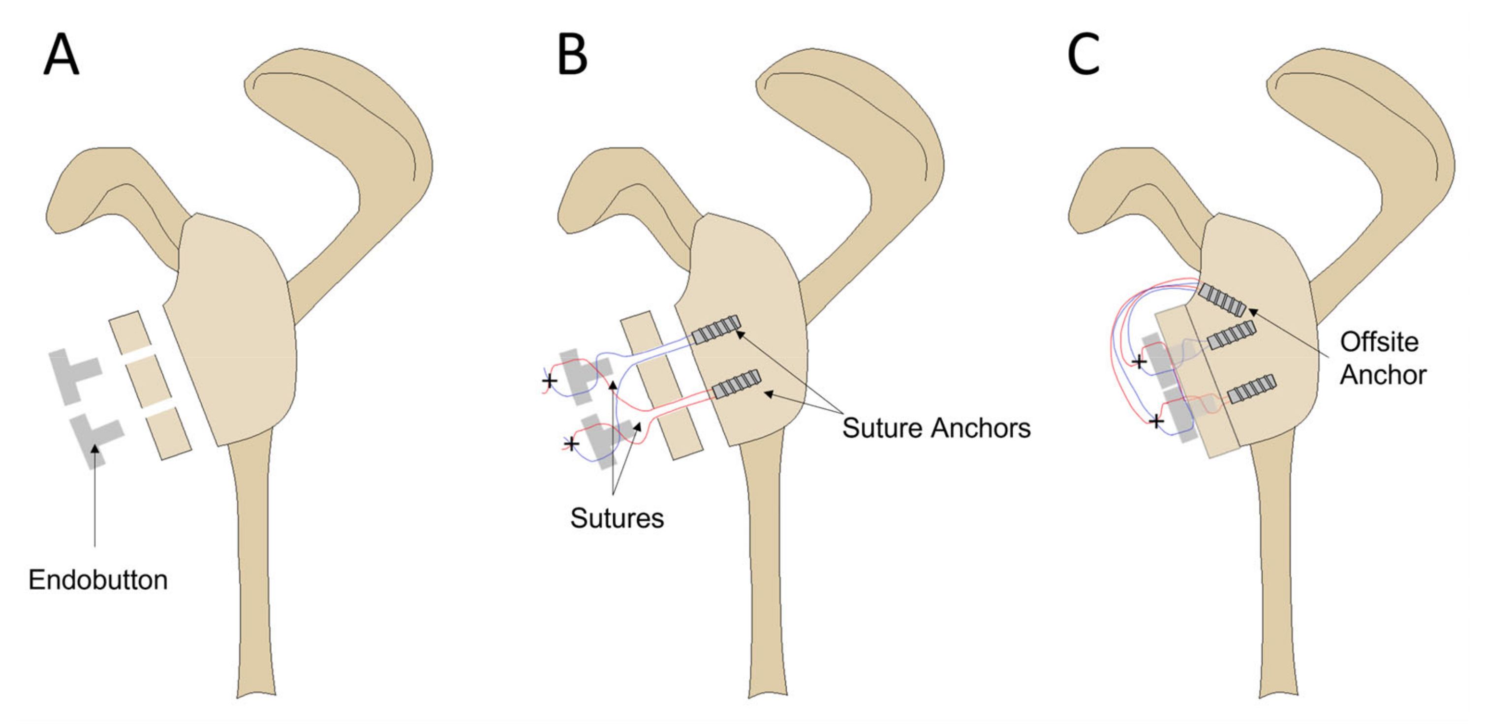 Jcm 12 04035 g003 Jcm 12 04035 g003