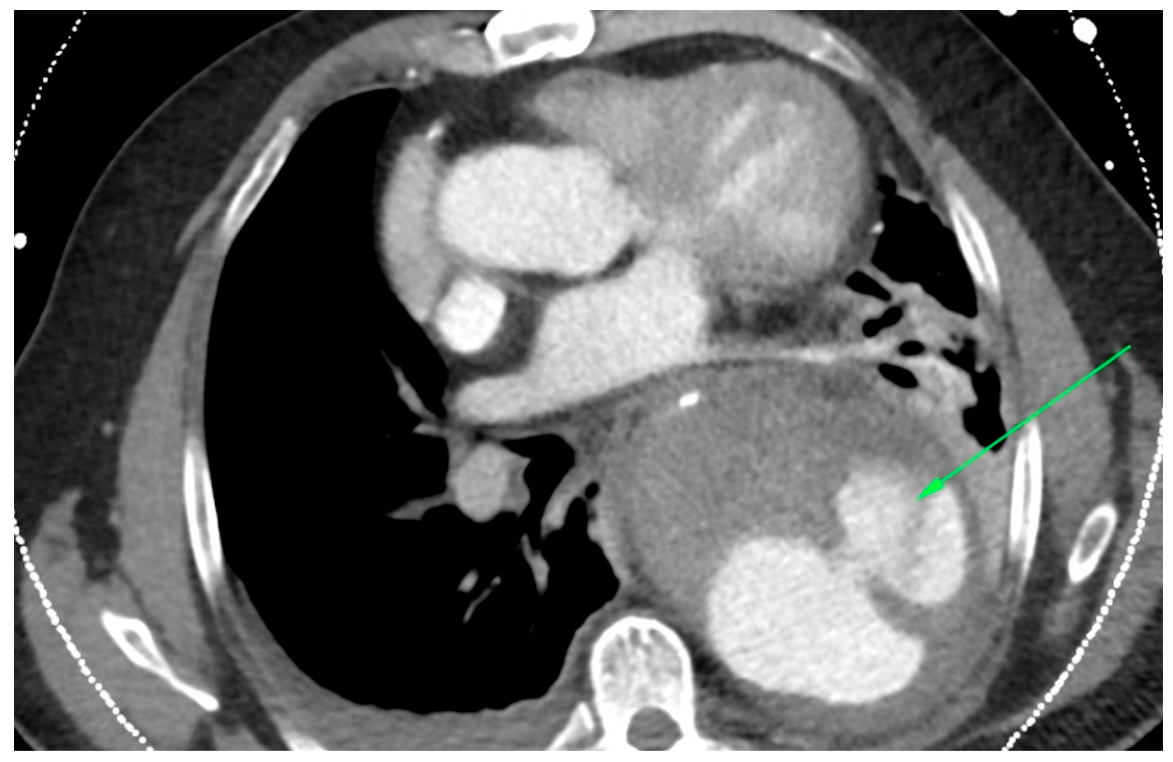 Jcm 12 04037 g001 Jcm 12 04037 g001