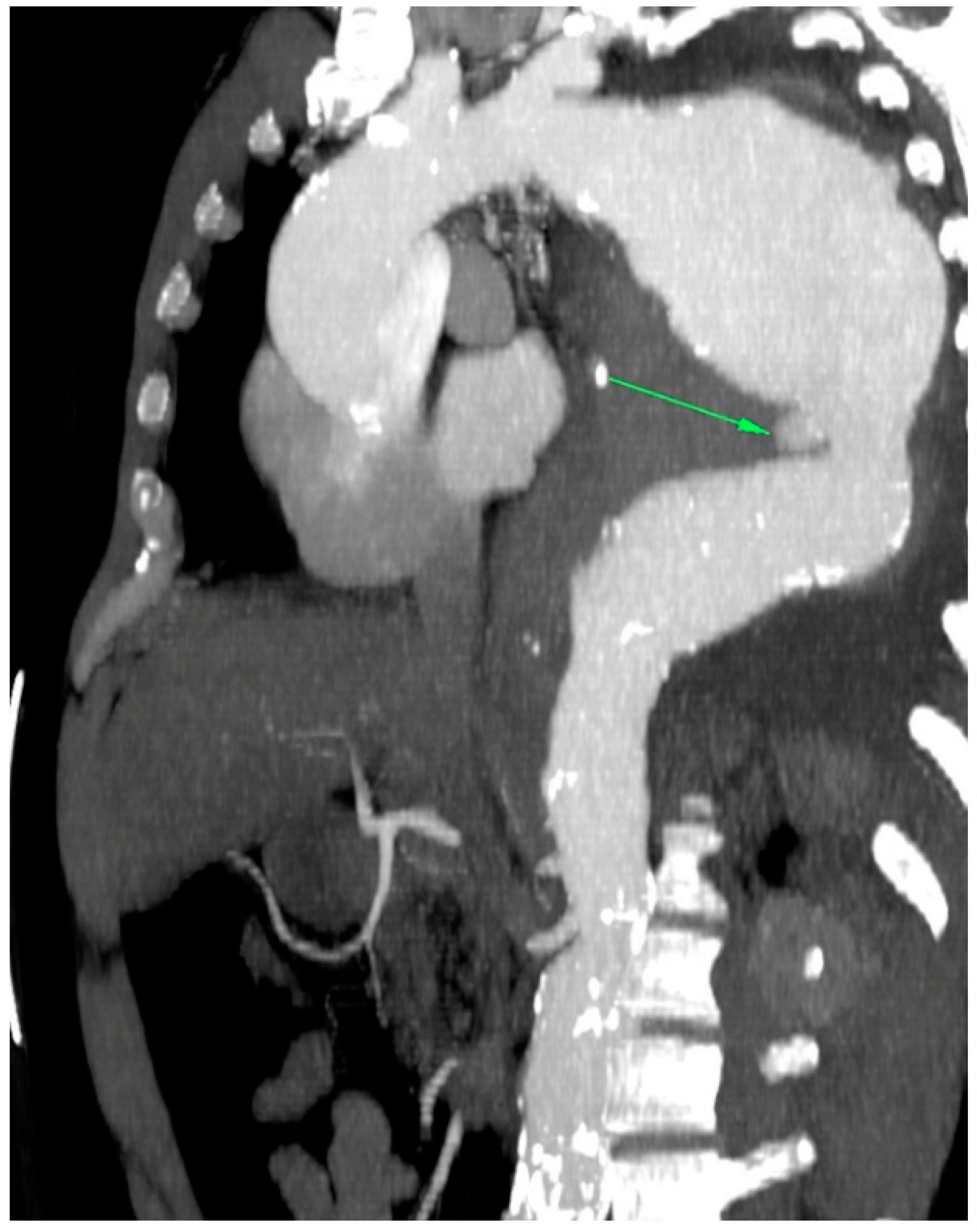 Jcm 12 04037 g002 Jcm 12 04037 g002