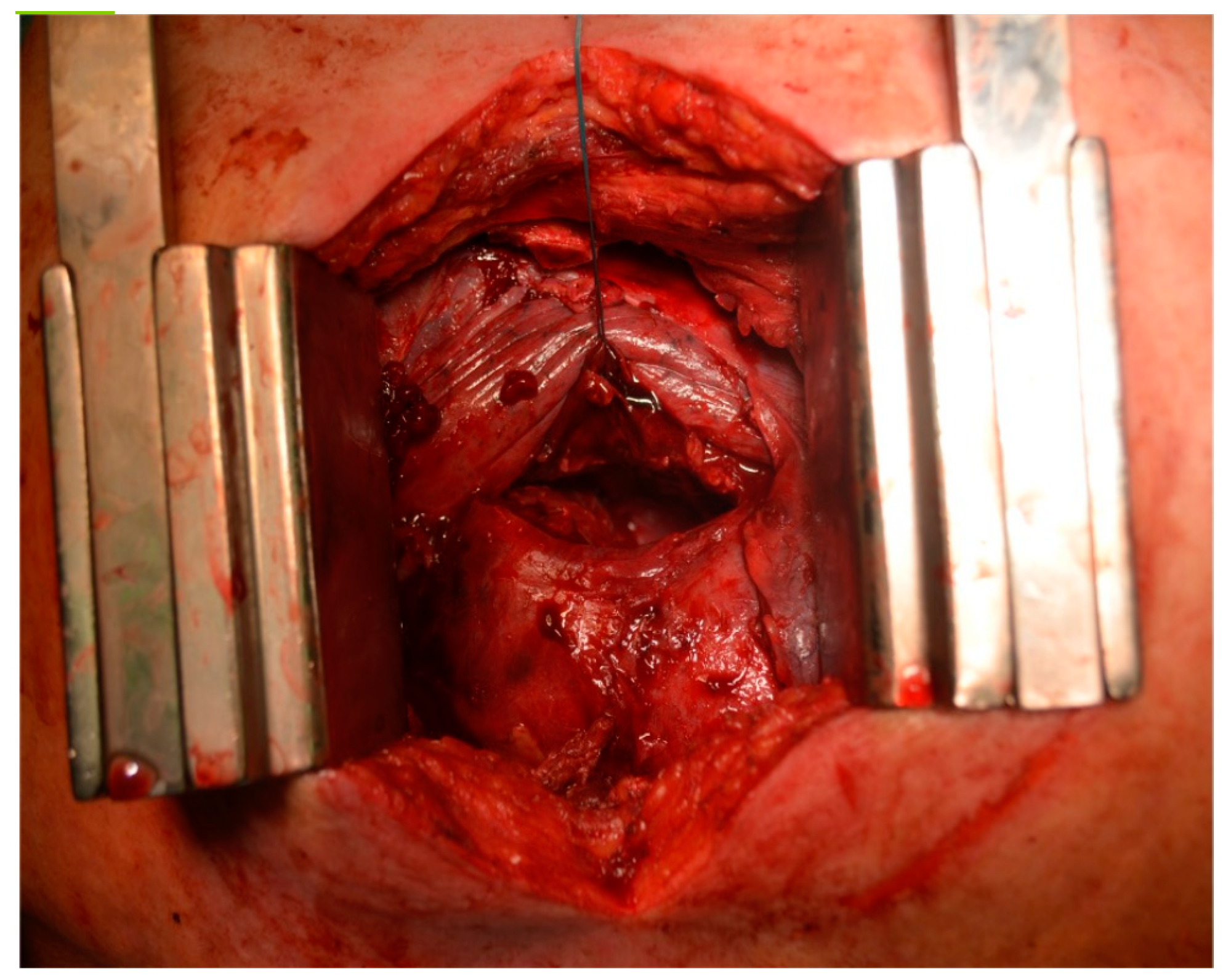 Jcm 12 04037 g003 Jcm 12 04037 g003