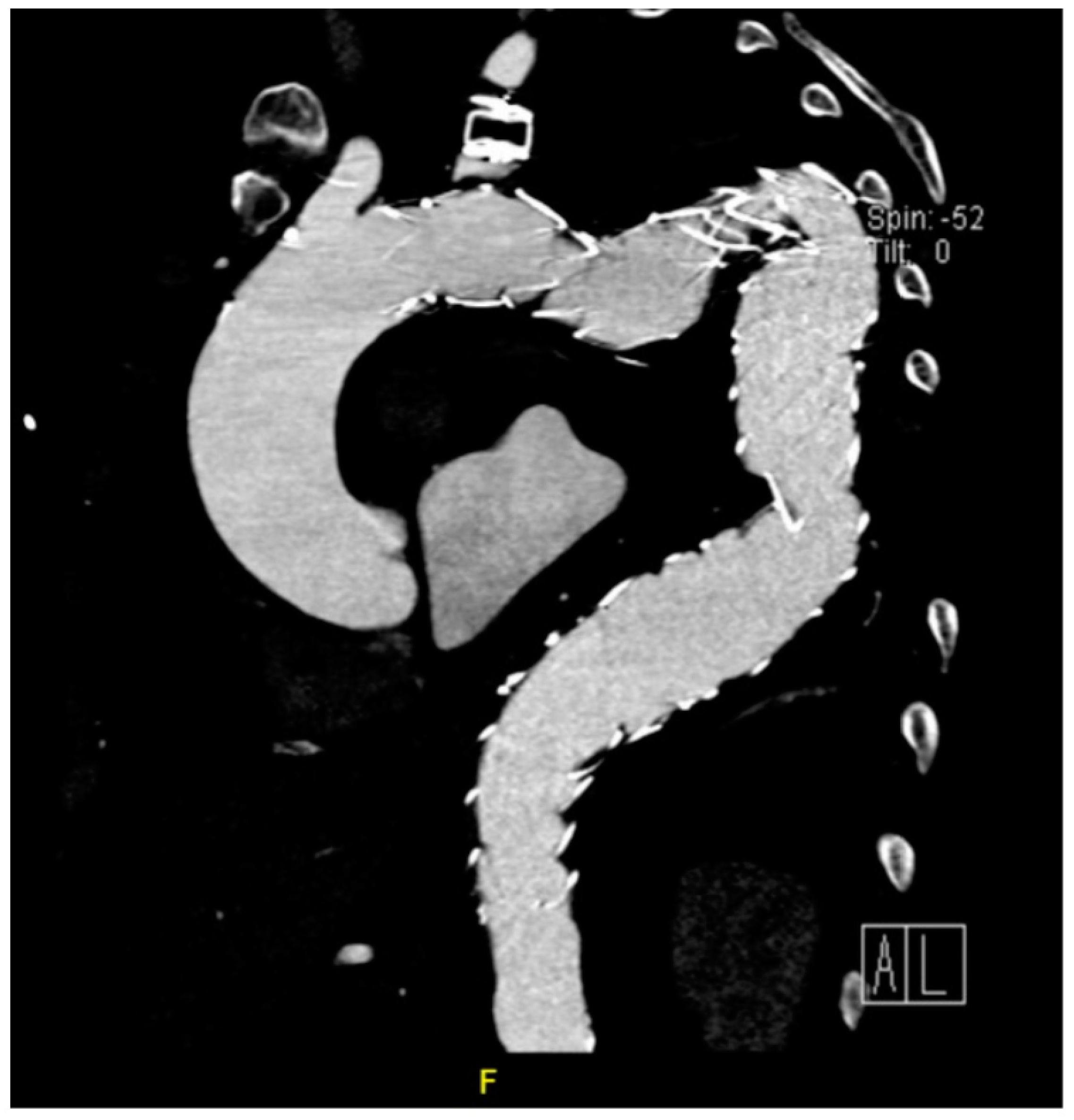 Jcm 12 04037 g005 Jcm 12 04037 g005