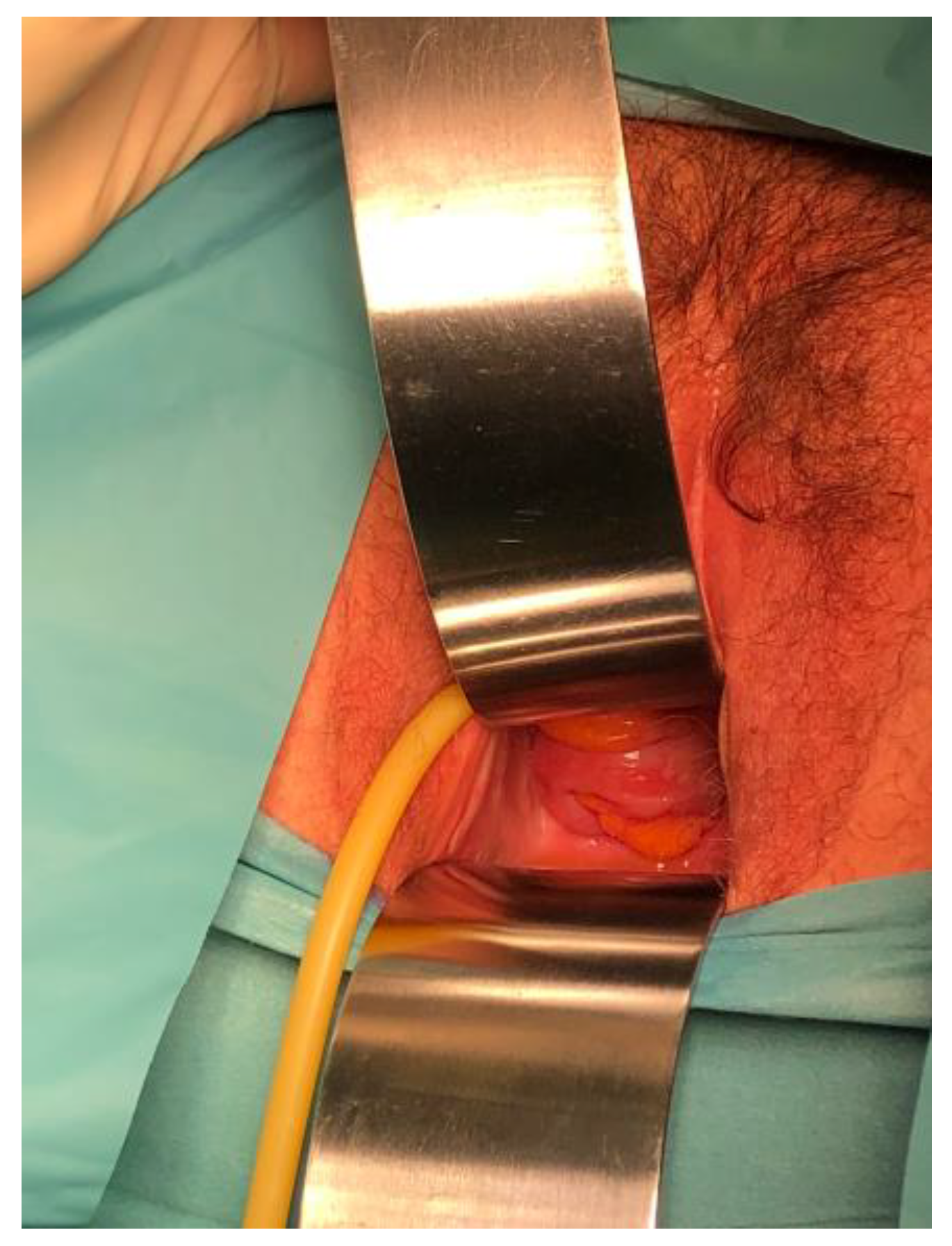 Jcm 12 04187 g002 Jcm 12 04187 g002