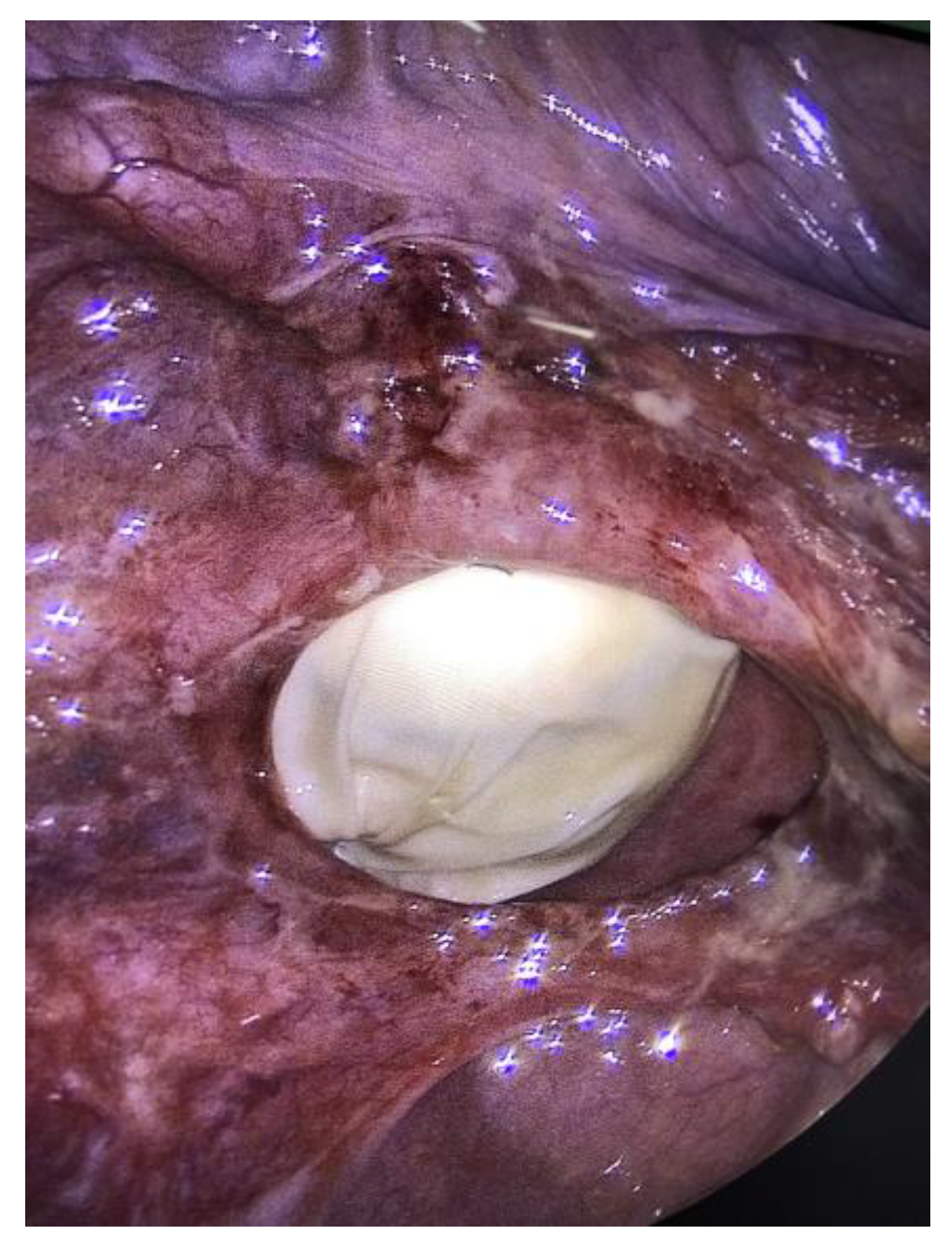 Jcm 12 04187 g003 Jcm 12 04187 g003