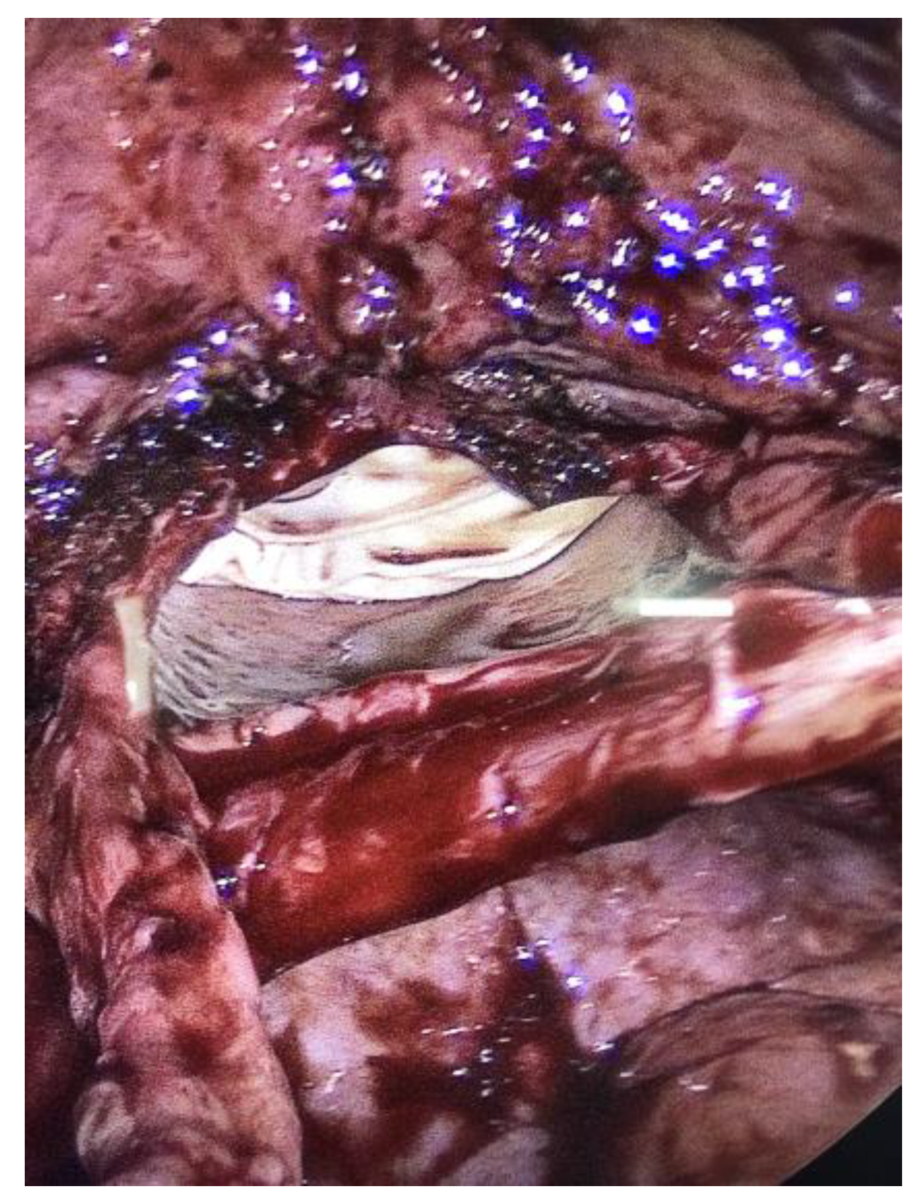 Jcm 12 04187 g004 Jcm 12 04187 g004