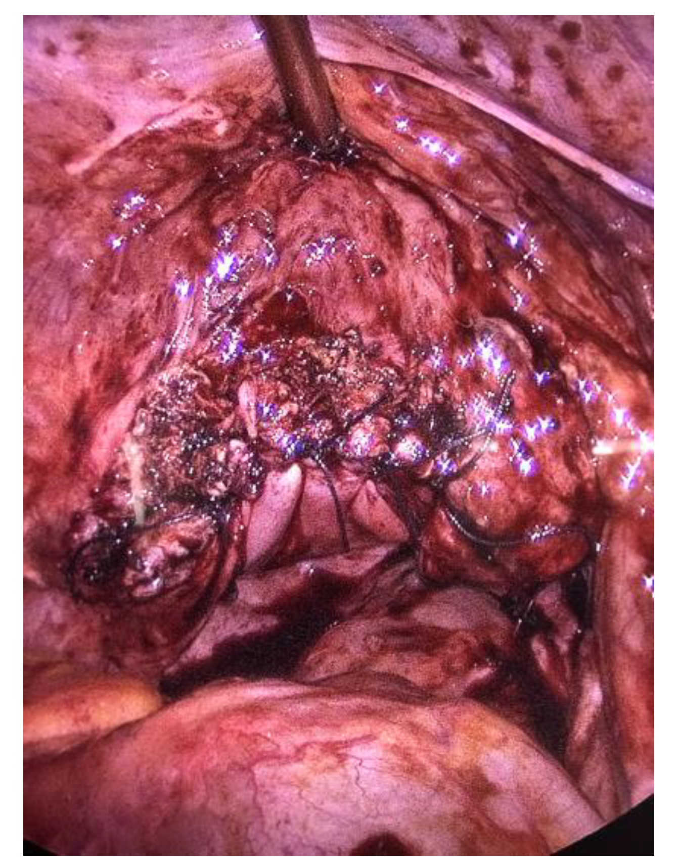 Jcm 12 04187 g005 Jcm 12 04187 g005