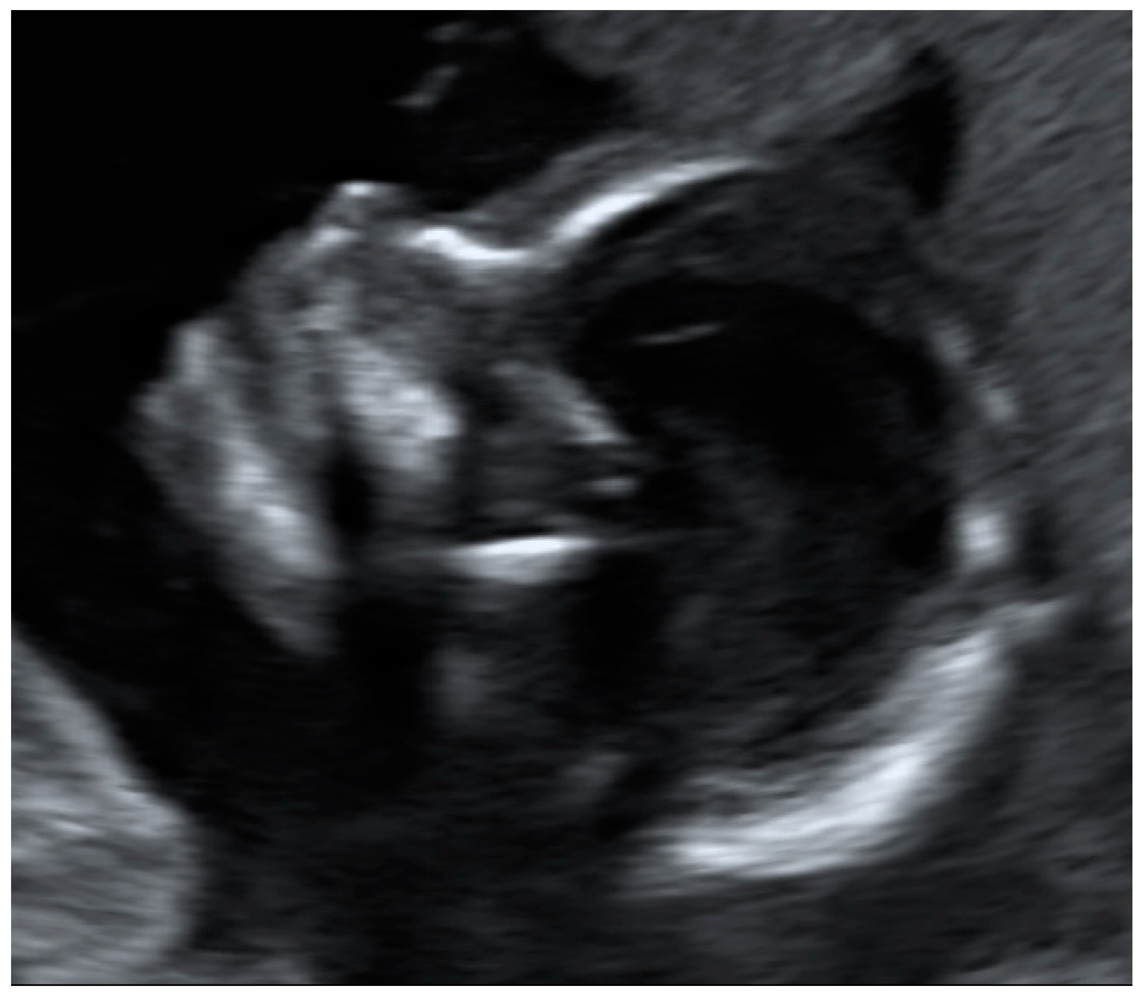 Jcm 12 04224 g001 Jcm 12 04224 g001