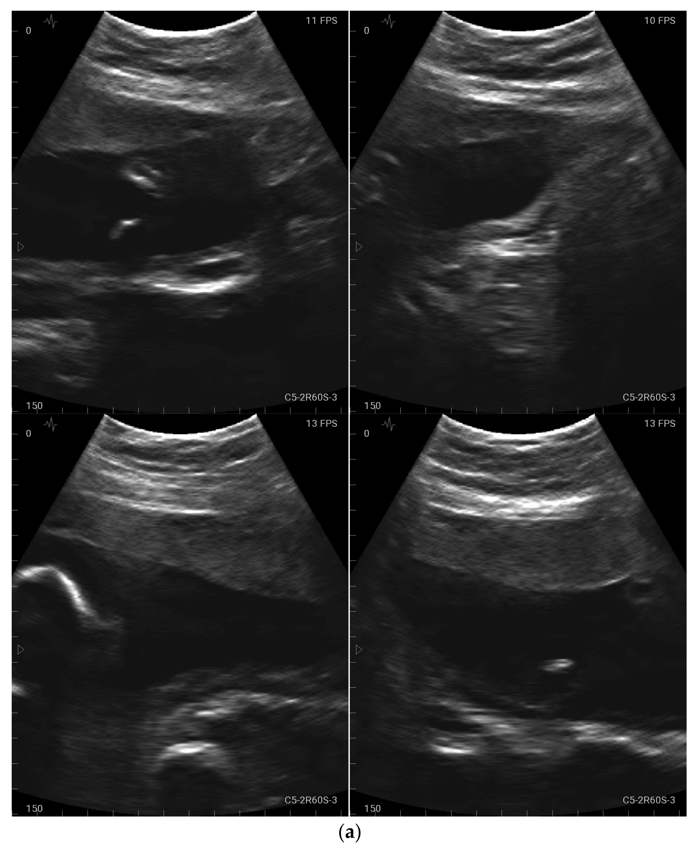 Jcm 12 04224 g003a Jcm 12 04224 g003a