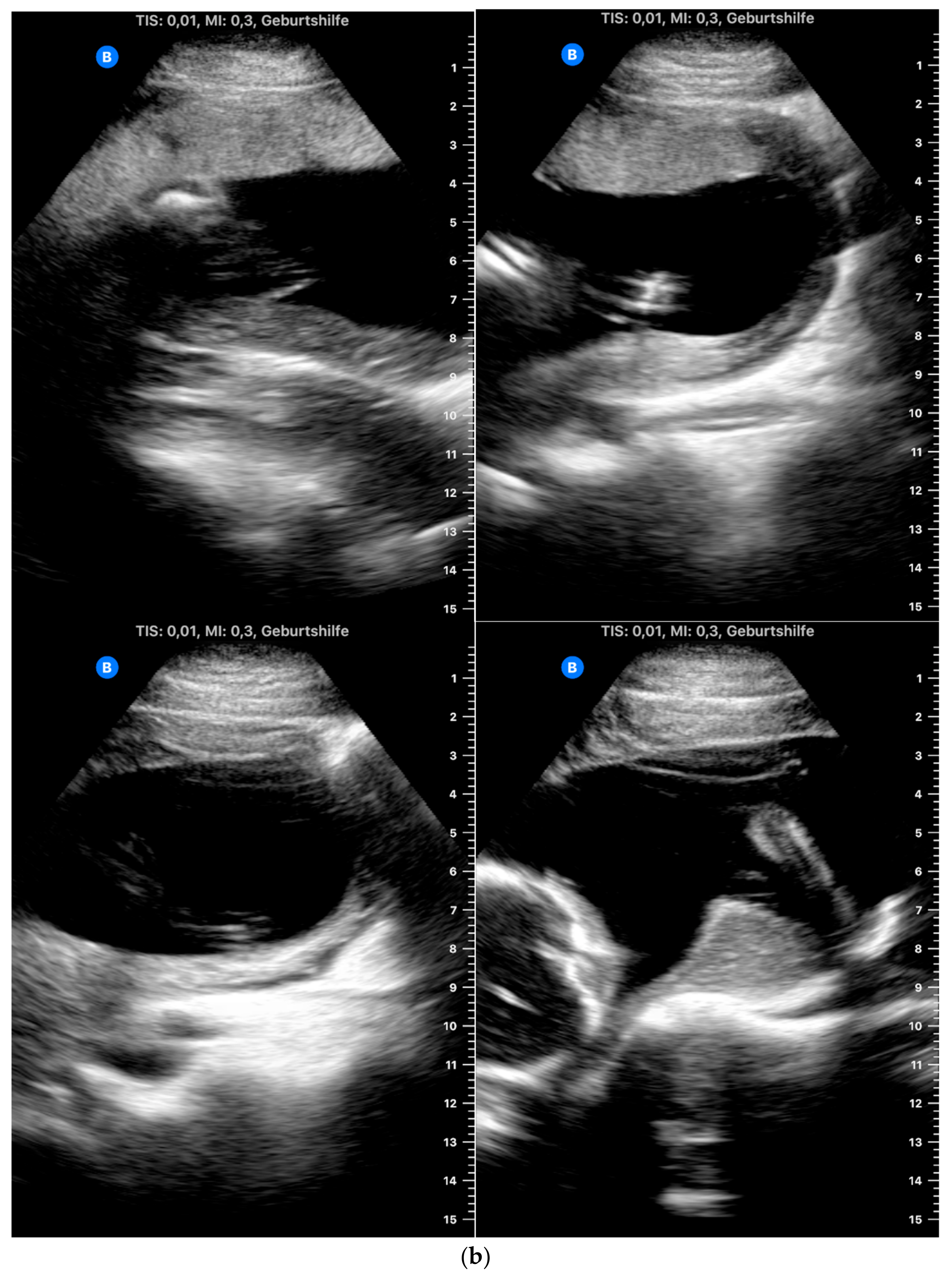 Jcm 12 04224 g003b Jcm 12 04224 g003b