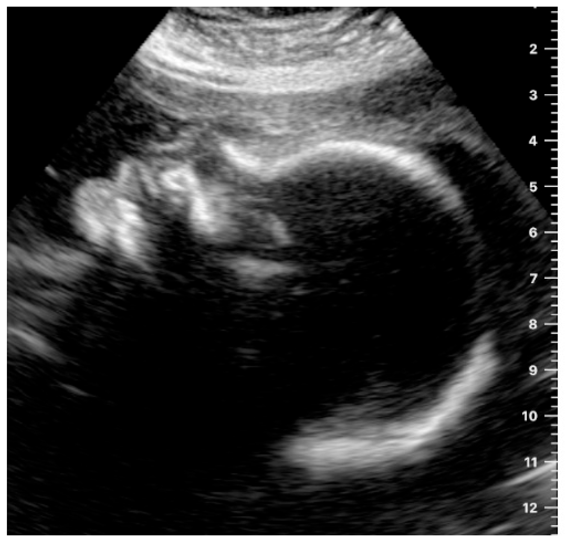 Jcm 12 04224 g004 Jcm 12 04224 g004