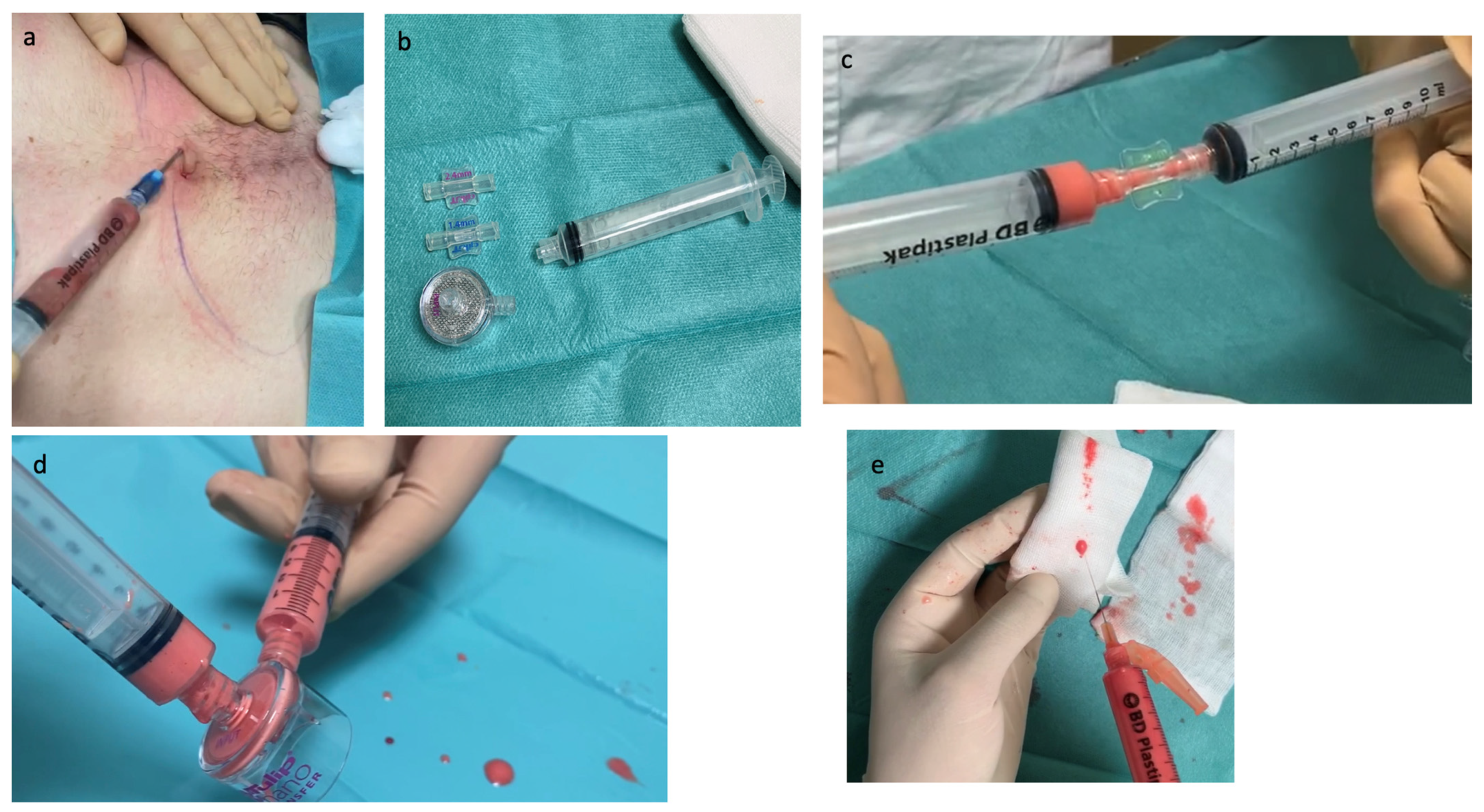 Jcm 12 04351 g003 Jcm 12 04351 g003