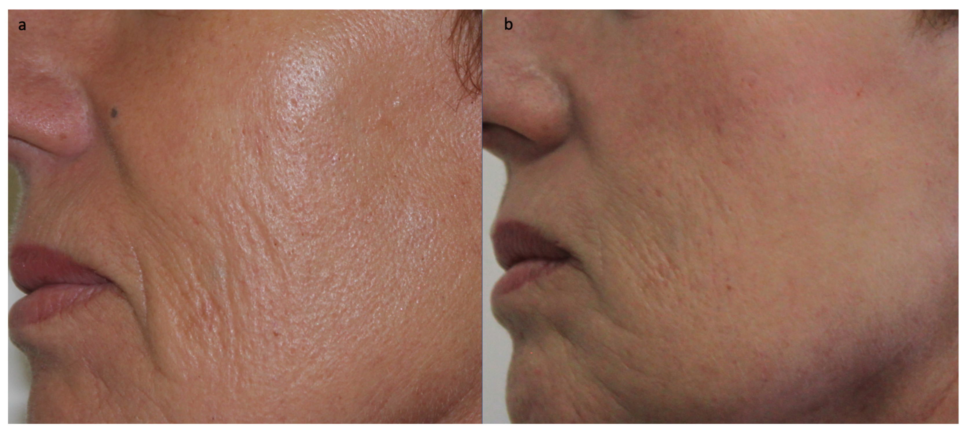 Jcm 12 04351 g004 Jcm 12 04351 g004