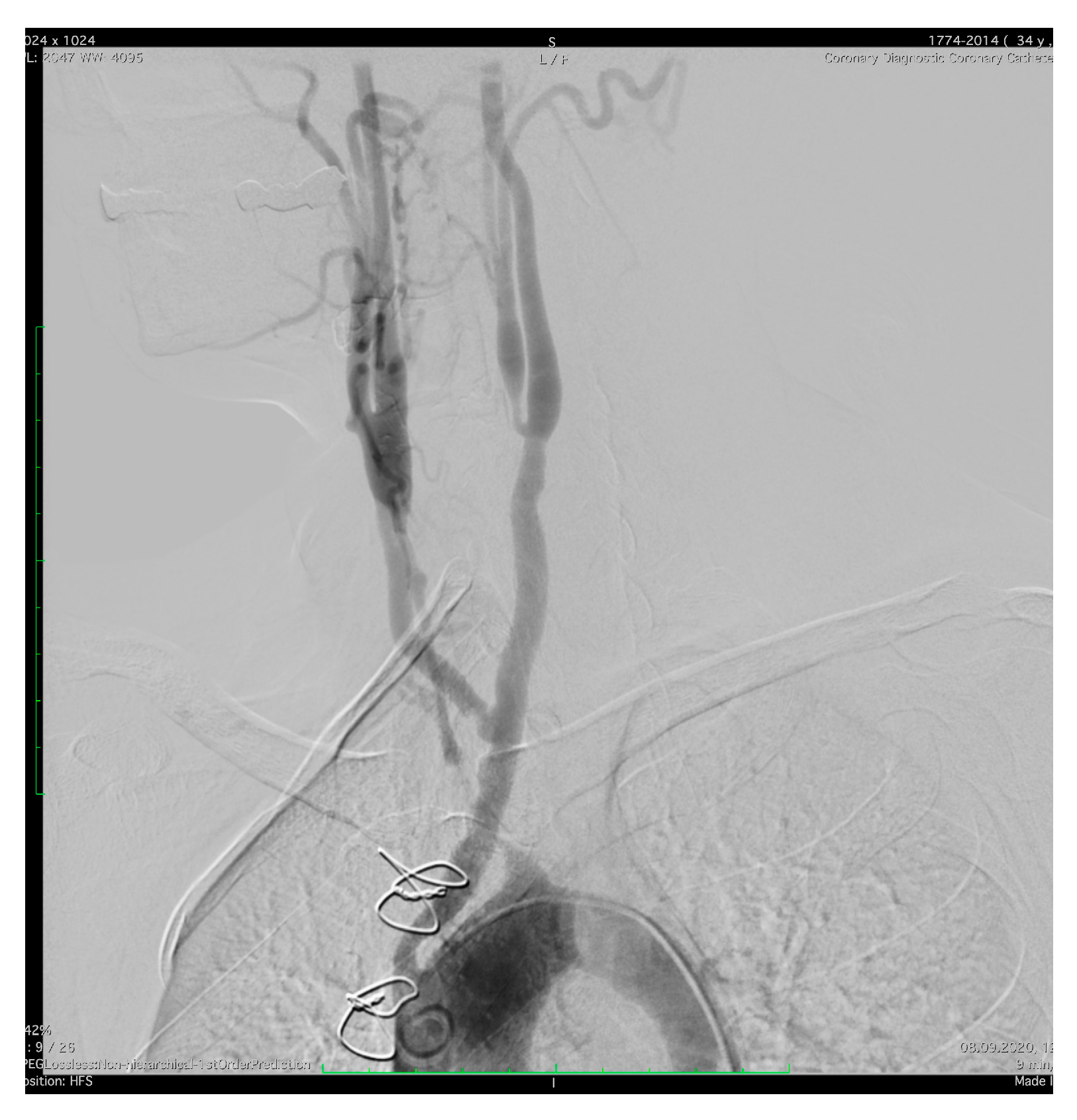 Jcm 12 04394 g004 Jcm 12 04394 g004