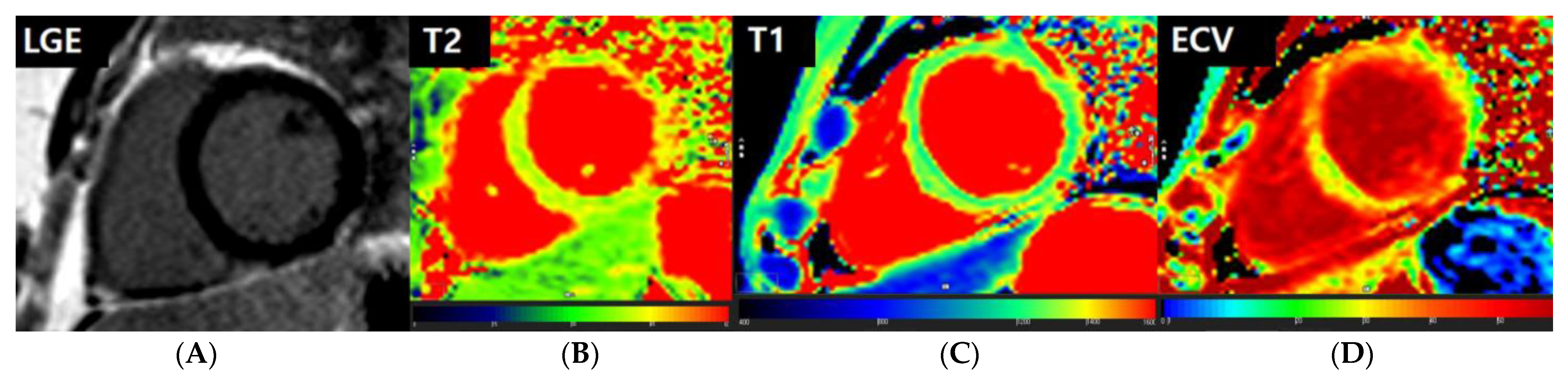 Jcm 12 04421 g004 Jcm 12 04421 g004