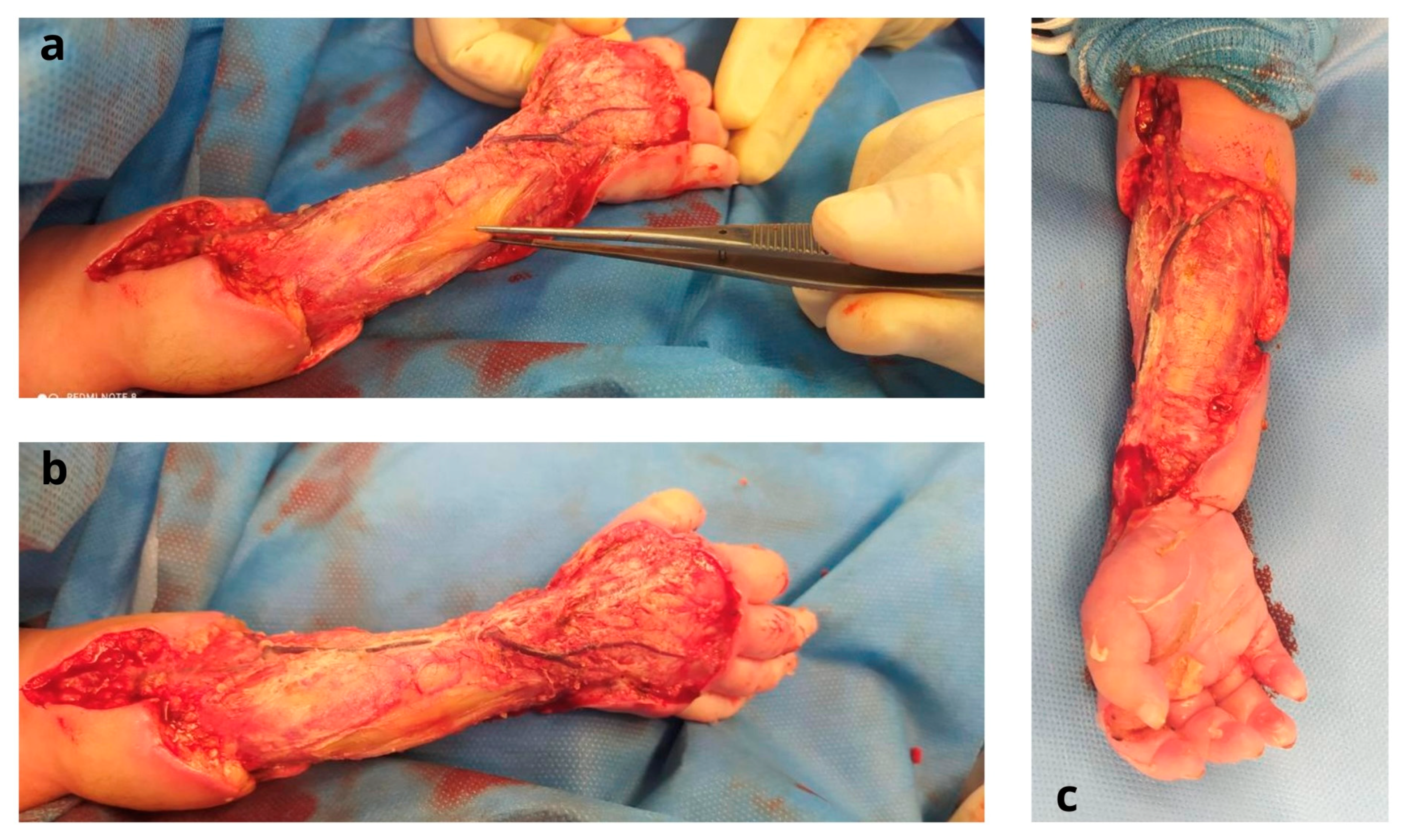 Jcm 12 04587 g002 Jcm 12 04587 g002