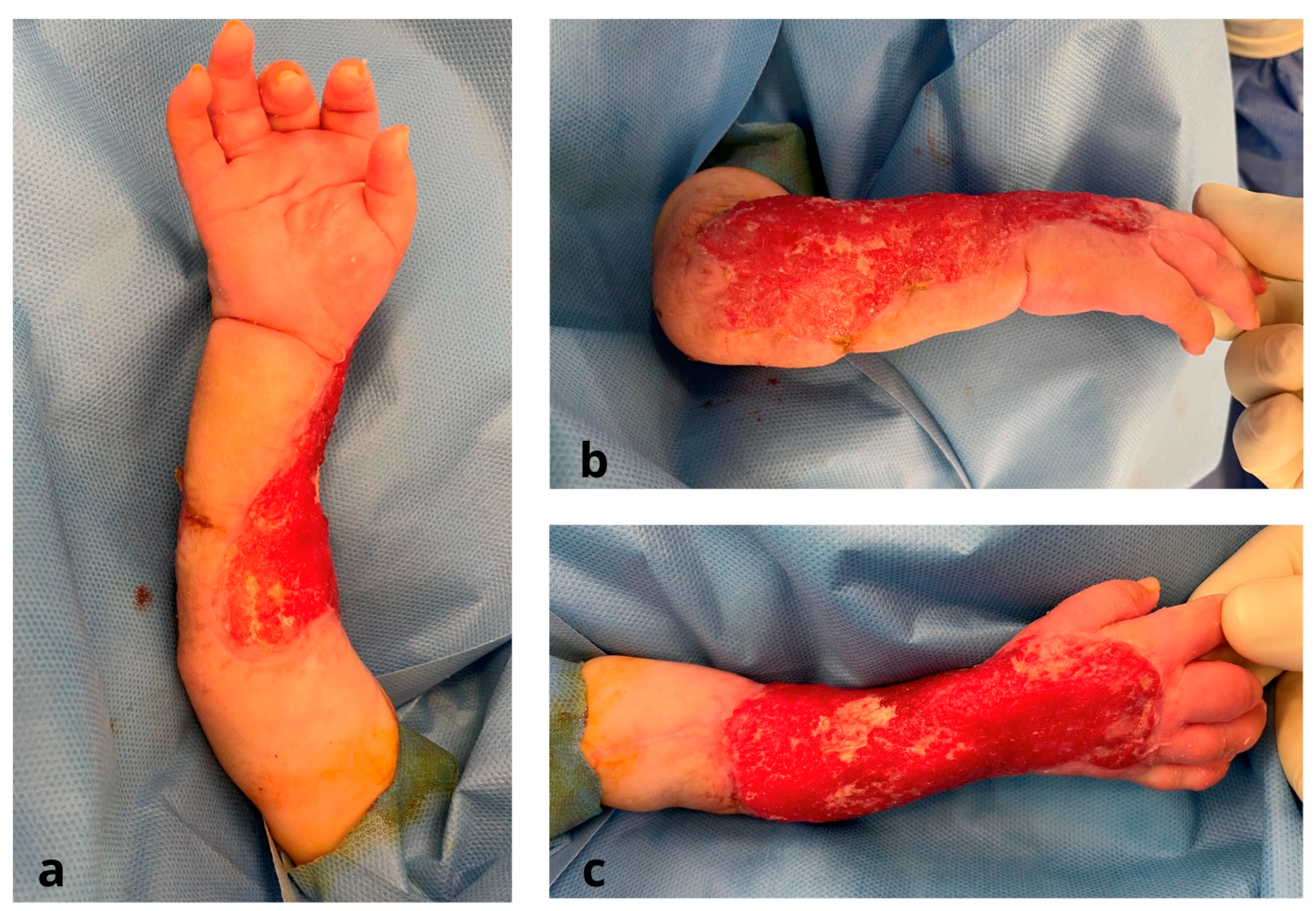 Jcm 12 04587 g003 Jcm 12 04587 g003