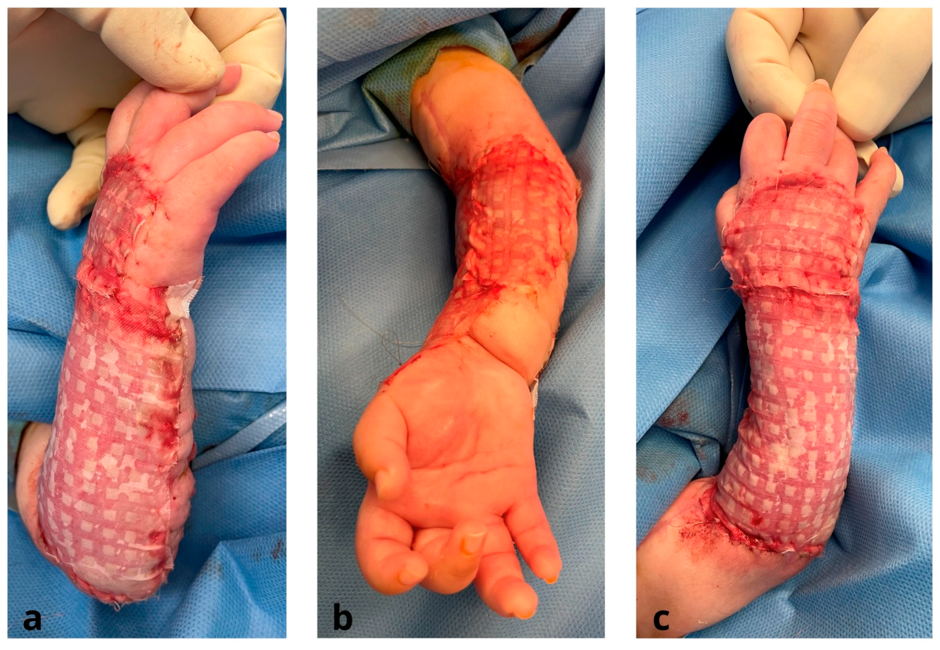 Jcm 12 04587 g004 Jcm 12 04587 g004