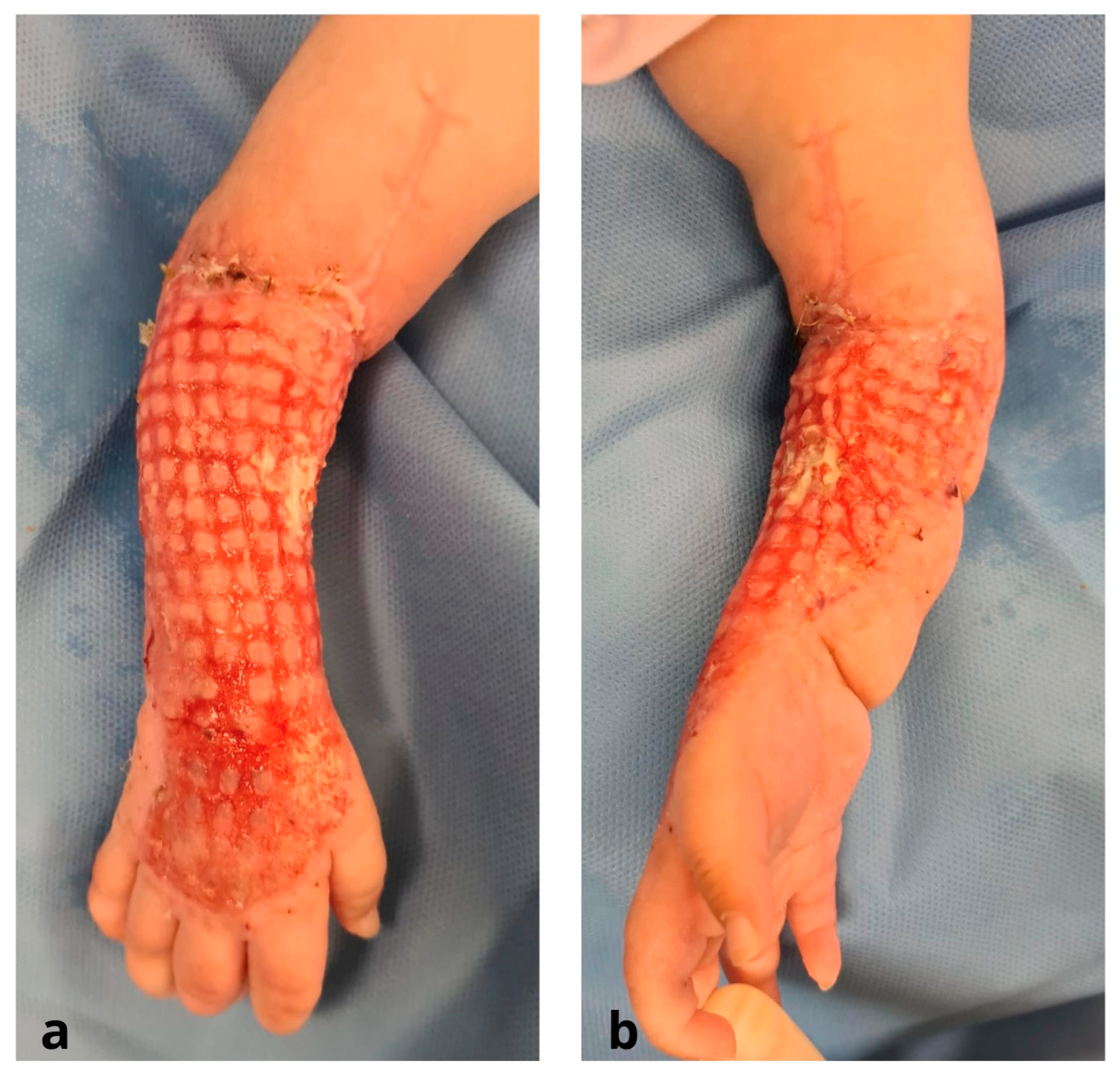 Jcm 12 04587 g005 Jcm 12 04587 g005