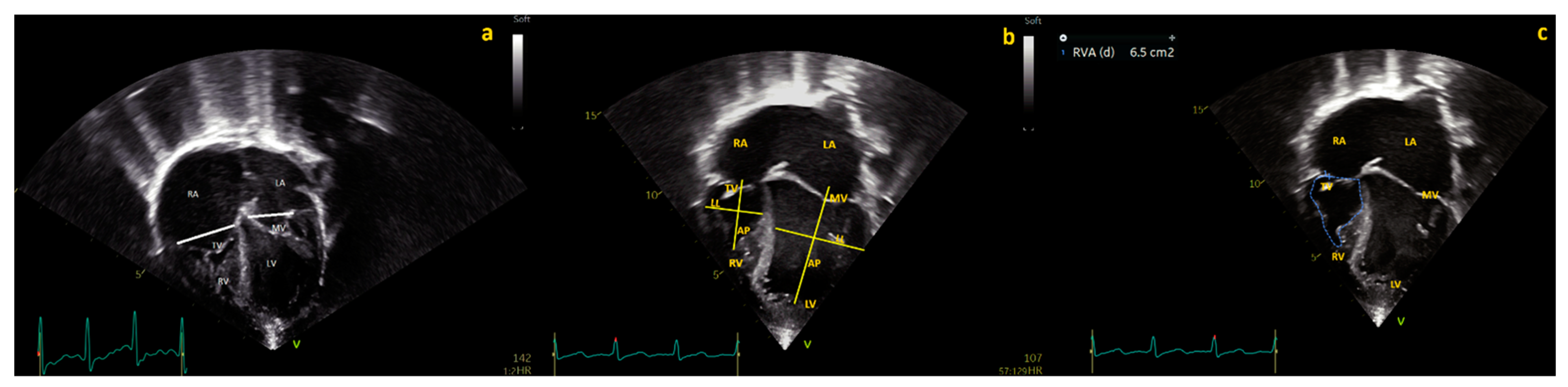 Jcm 12 04599 g002 Jcm 12 04599 g002