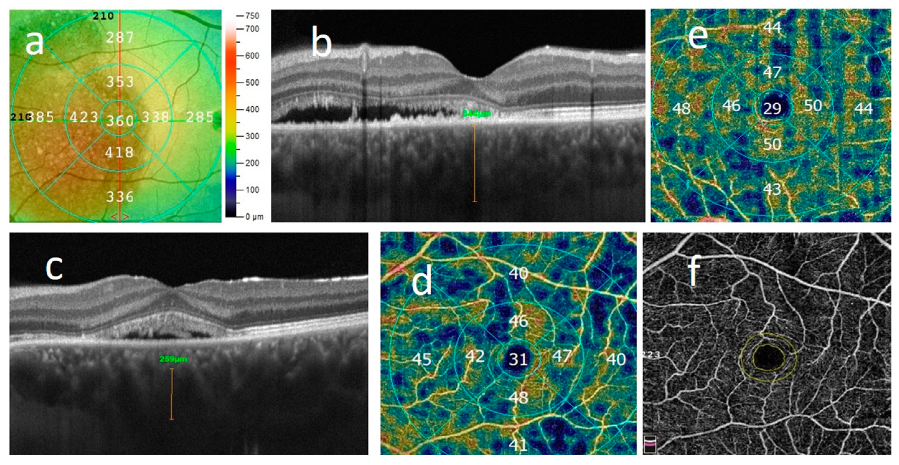 Jcm 12 04817 g002 Jcm 12 04817 g002