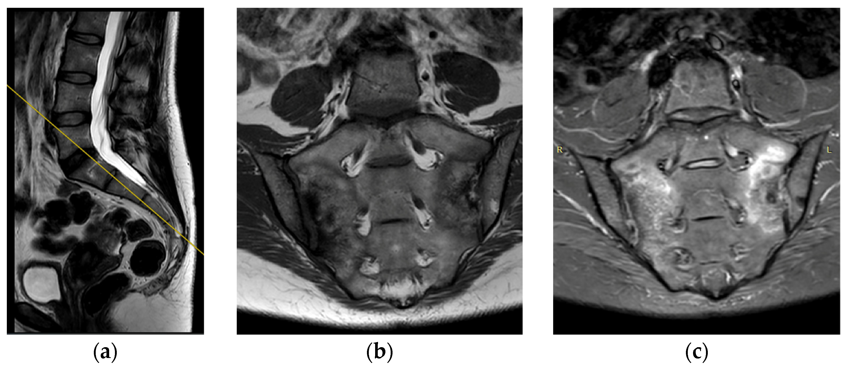 Jcm 12 04852 g002 Jcm 12 04852 g002