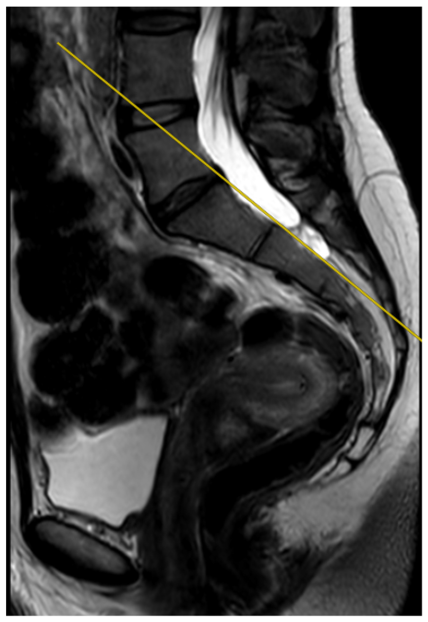 Jcm 12 04852 g004 Jcm 12 04852 g004