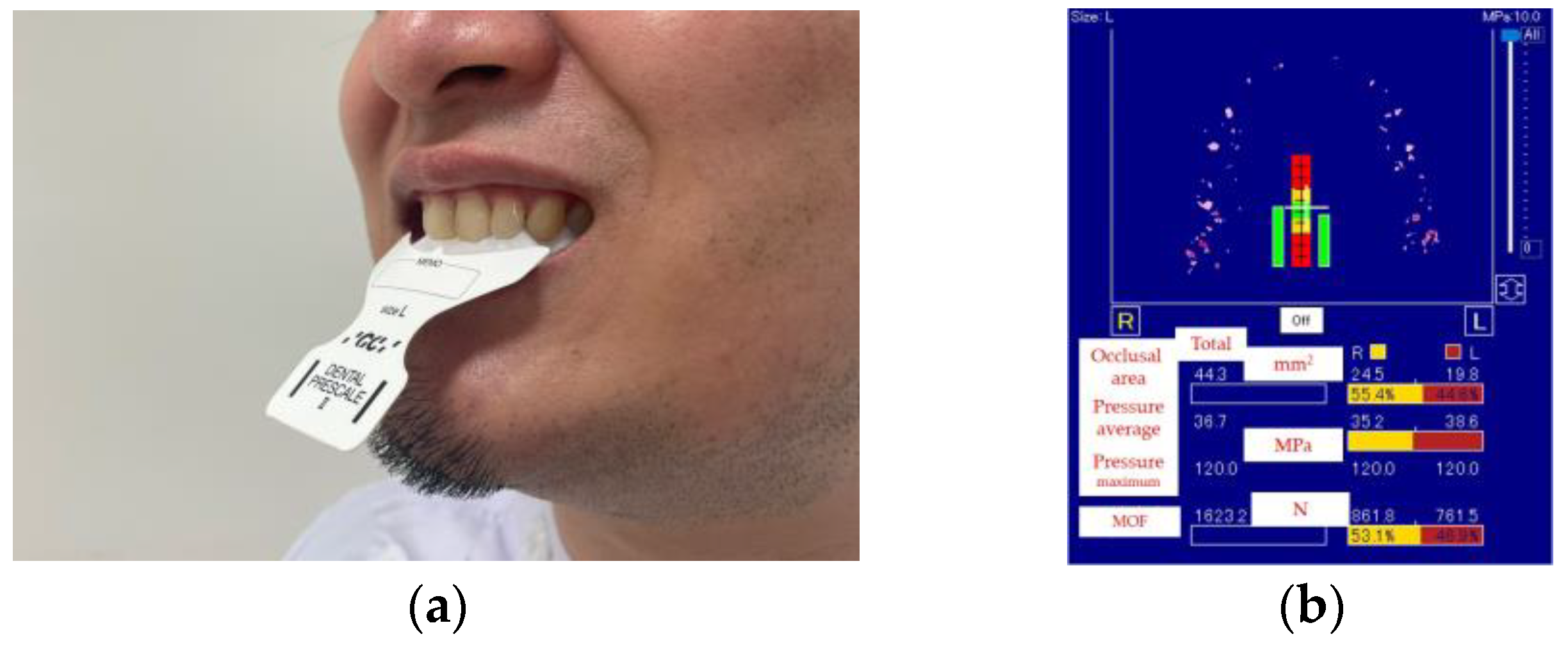 Jcm 12 05117 g003 Jcm 12 05117 g003