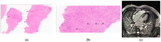 Jcm 12 05278 g001a Jcm 12 05278 g001a