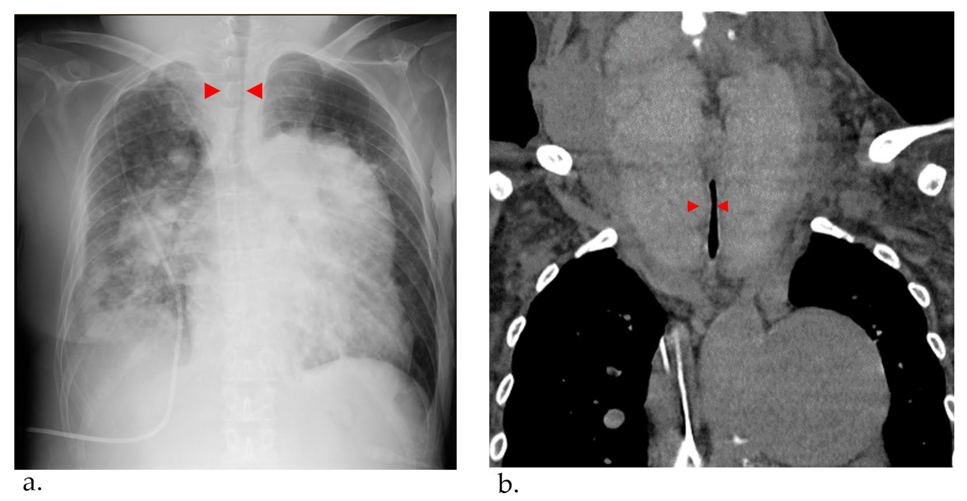 Jcm 12 06359 g003 Jcm 12 06359 g003