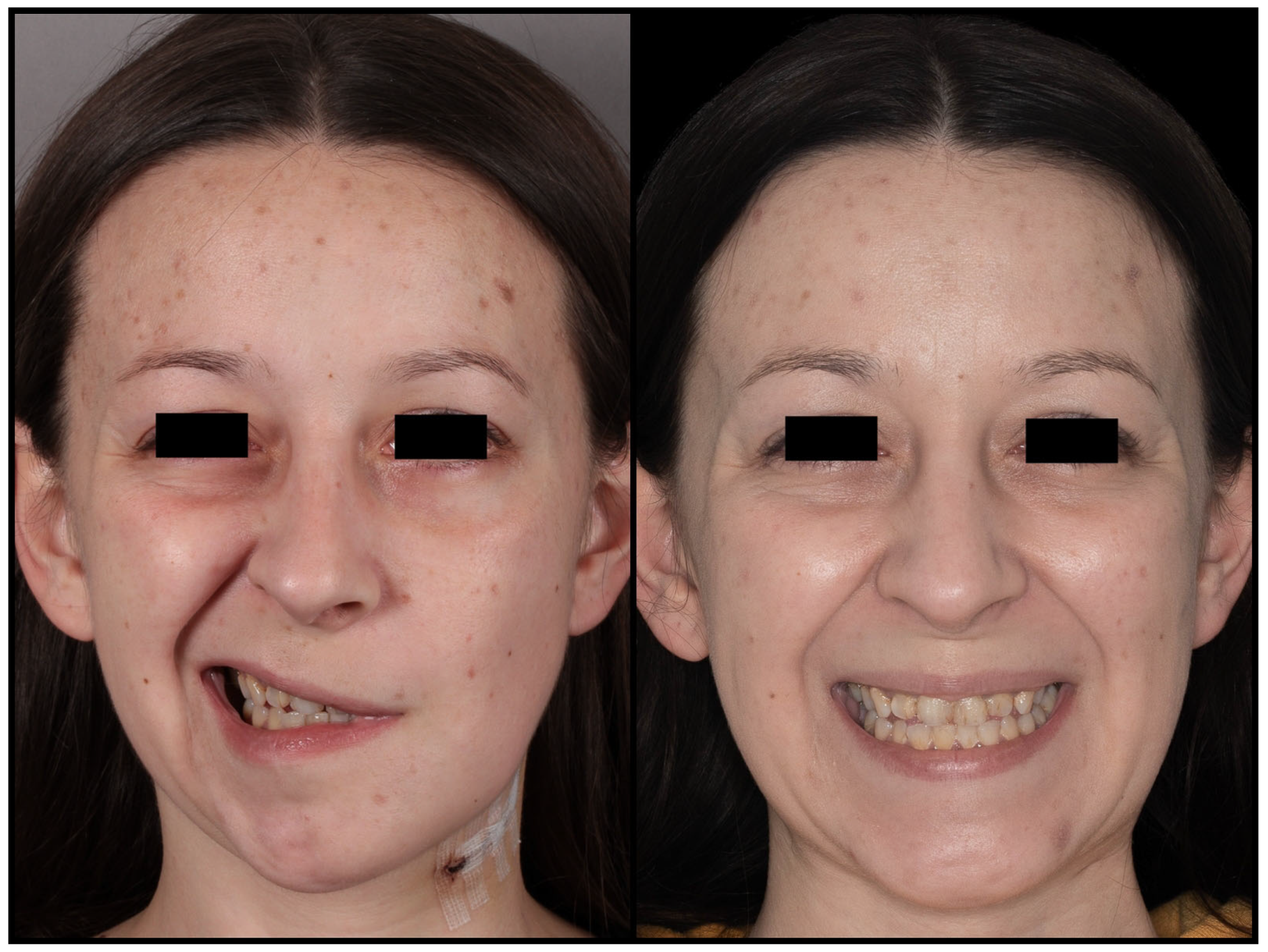 Jcm 12 06763 g009 Jcm 12 06763 g009