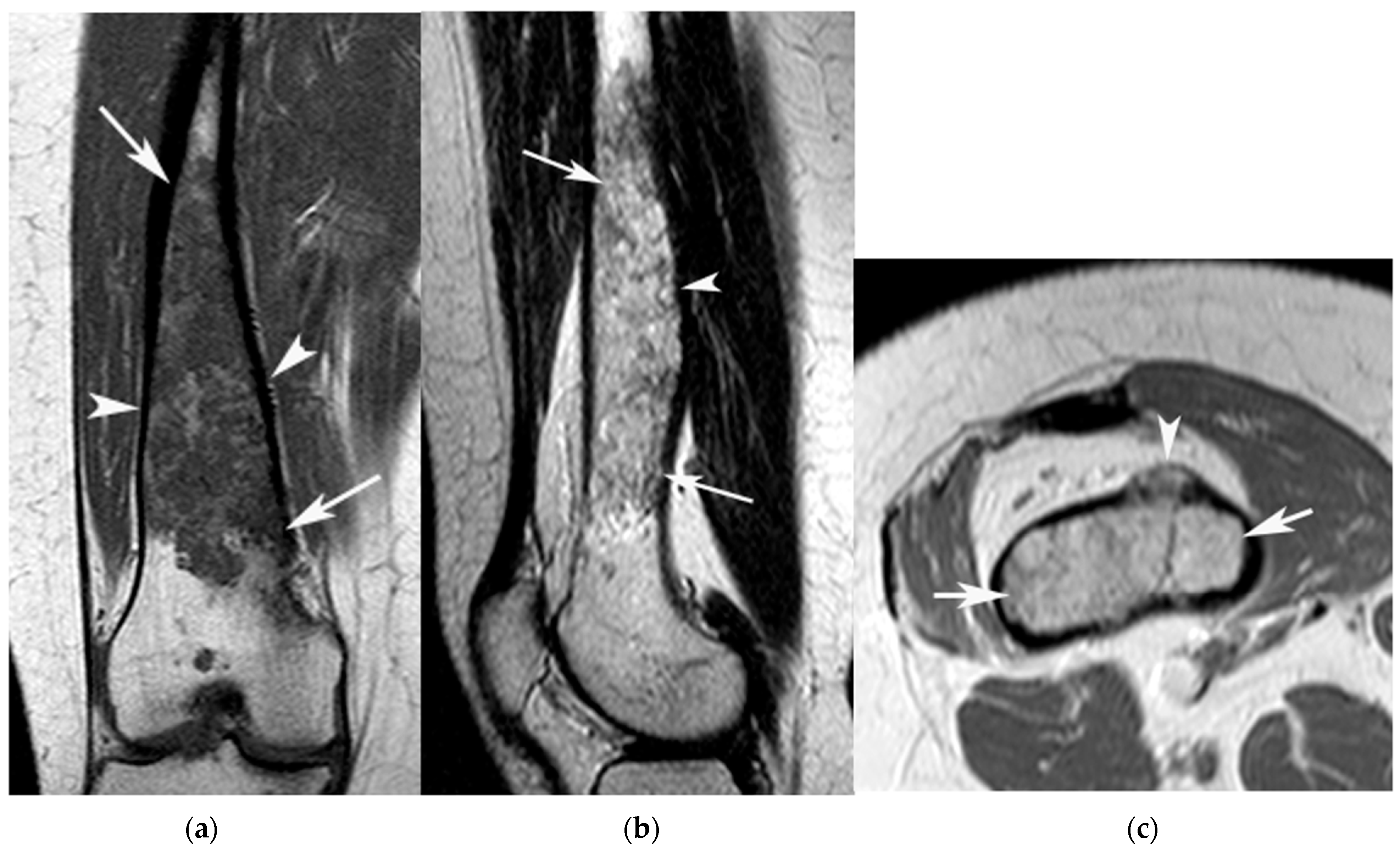 Jcm 12 06905 g004 Jcm 12 06905 g004
