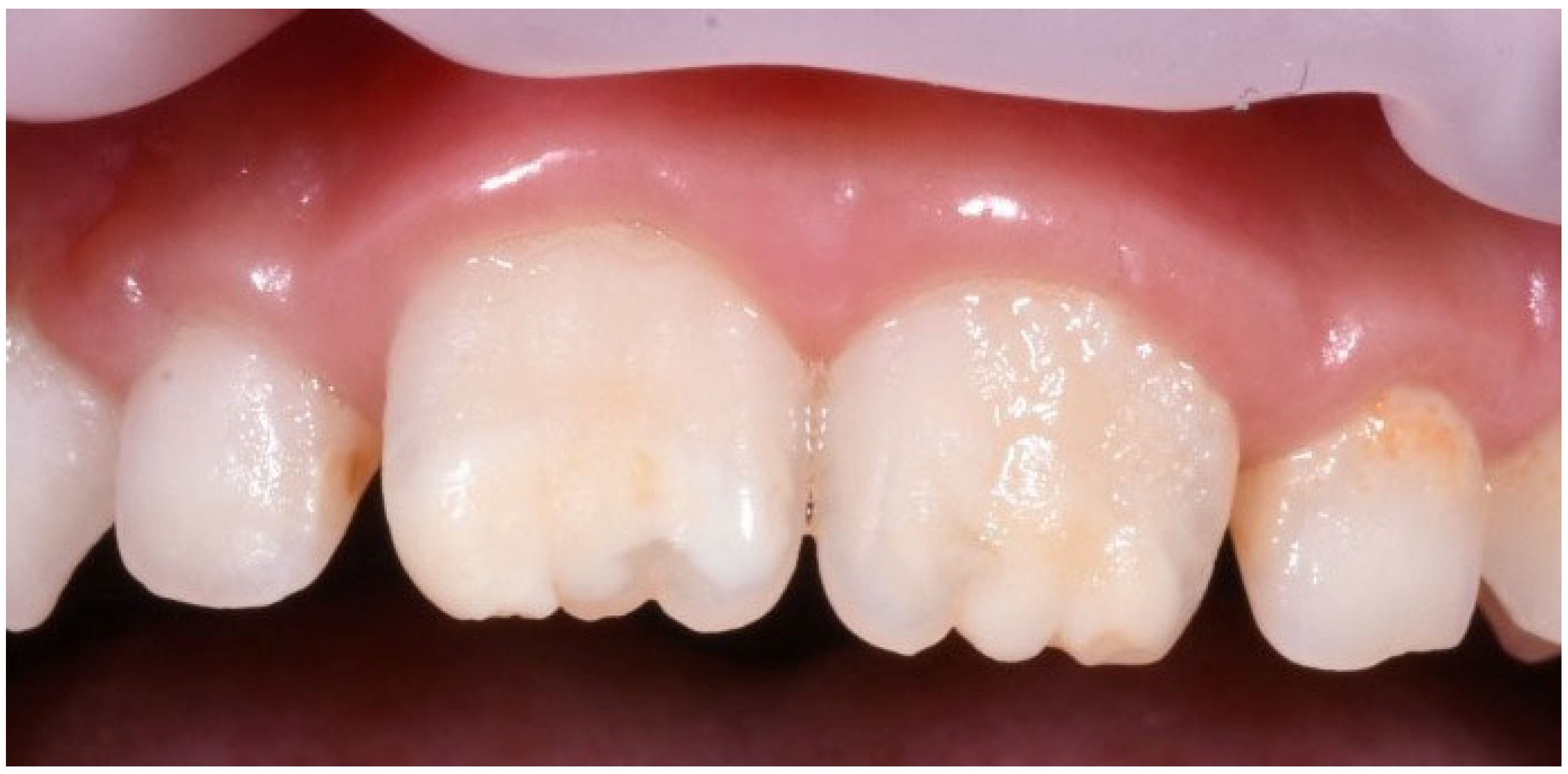 Jcm 12 07194 g002 Jcm 12 07194 g002