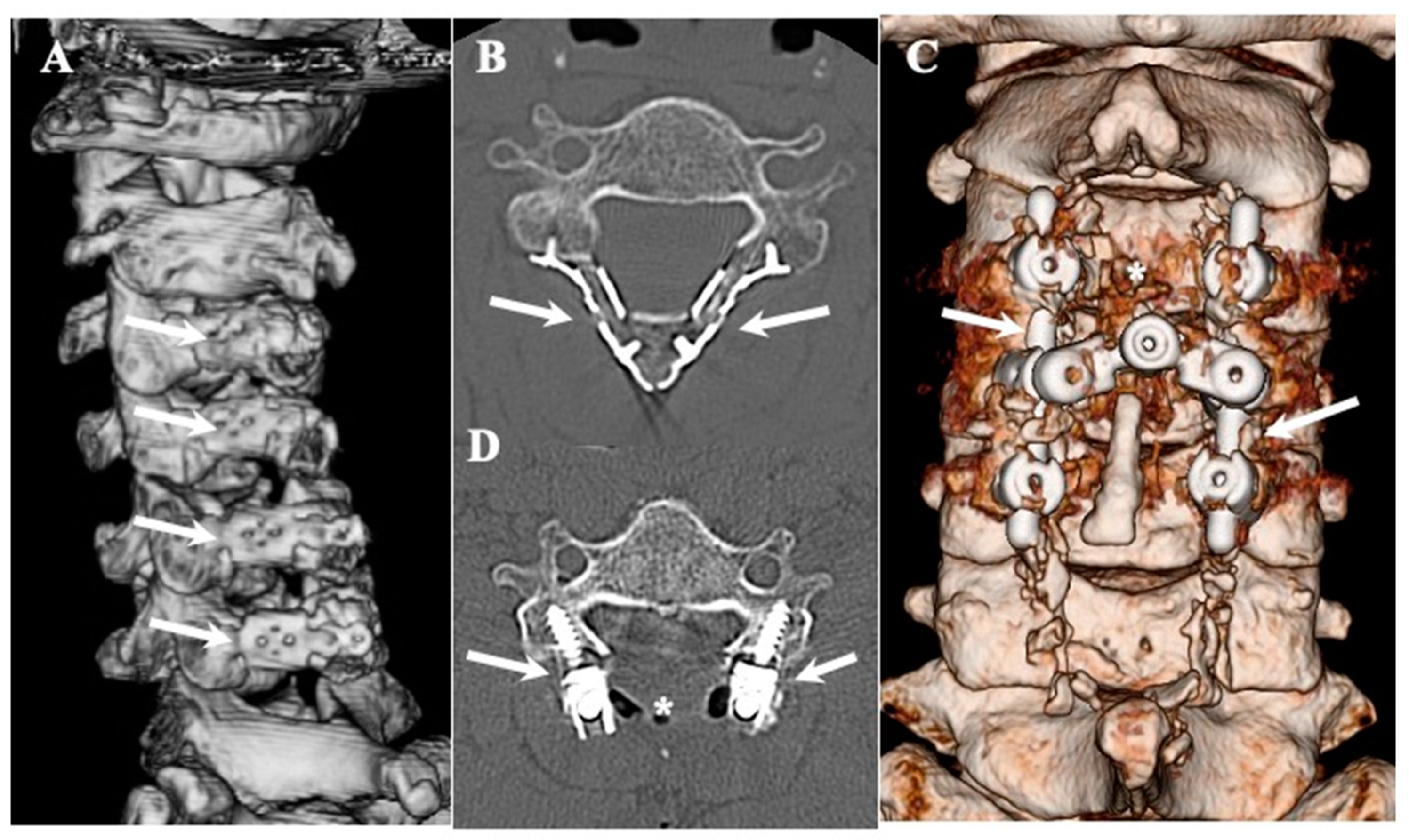Jcm 13 00105 g001 Jcm 13 00105 g001