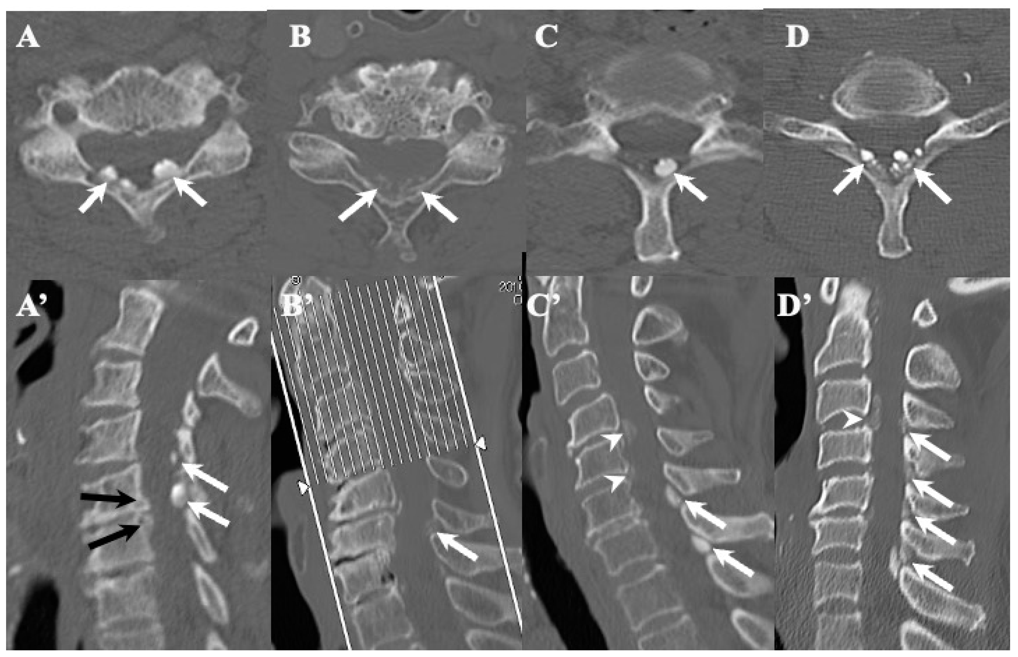 Jcm 13 00105 g003 Jcm 13 00105 g003