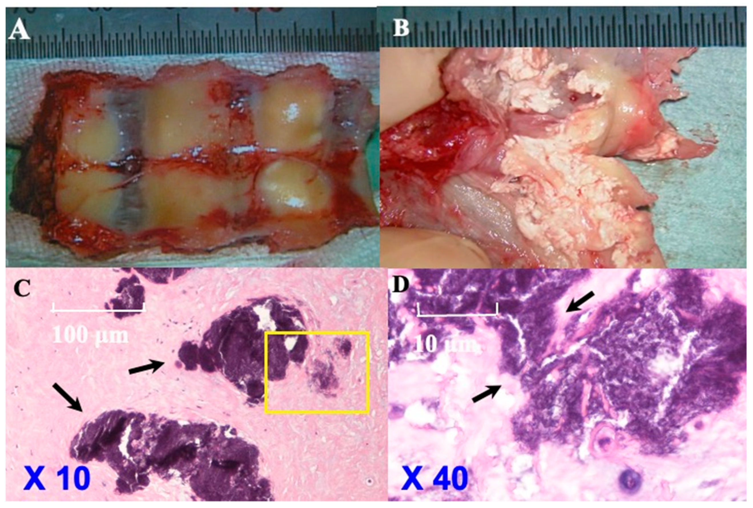 Jcm 13 00105 g007 Jcm 13 00105 g007