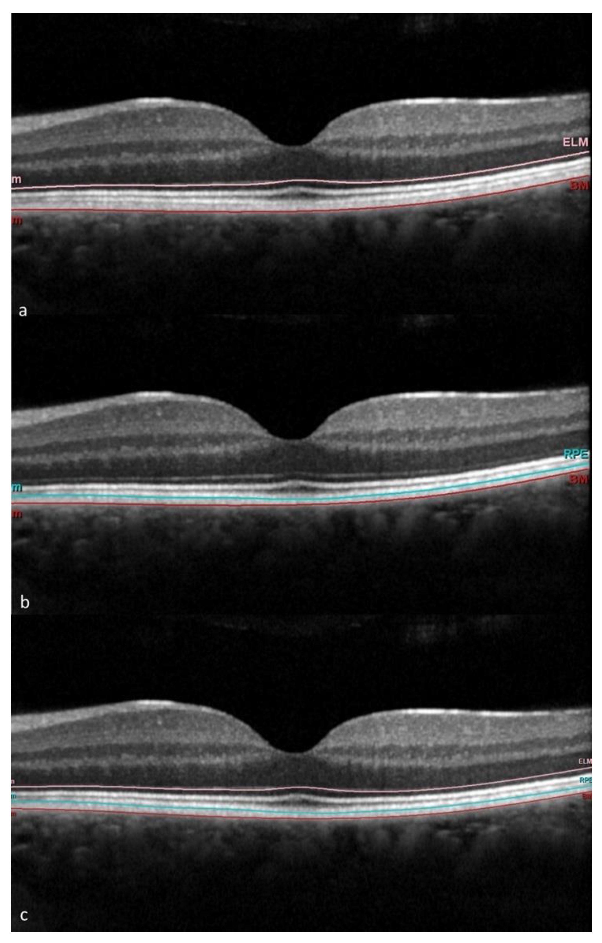 Jcm 13 00229 g001 Jcm 13 00229 g001