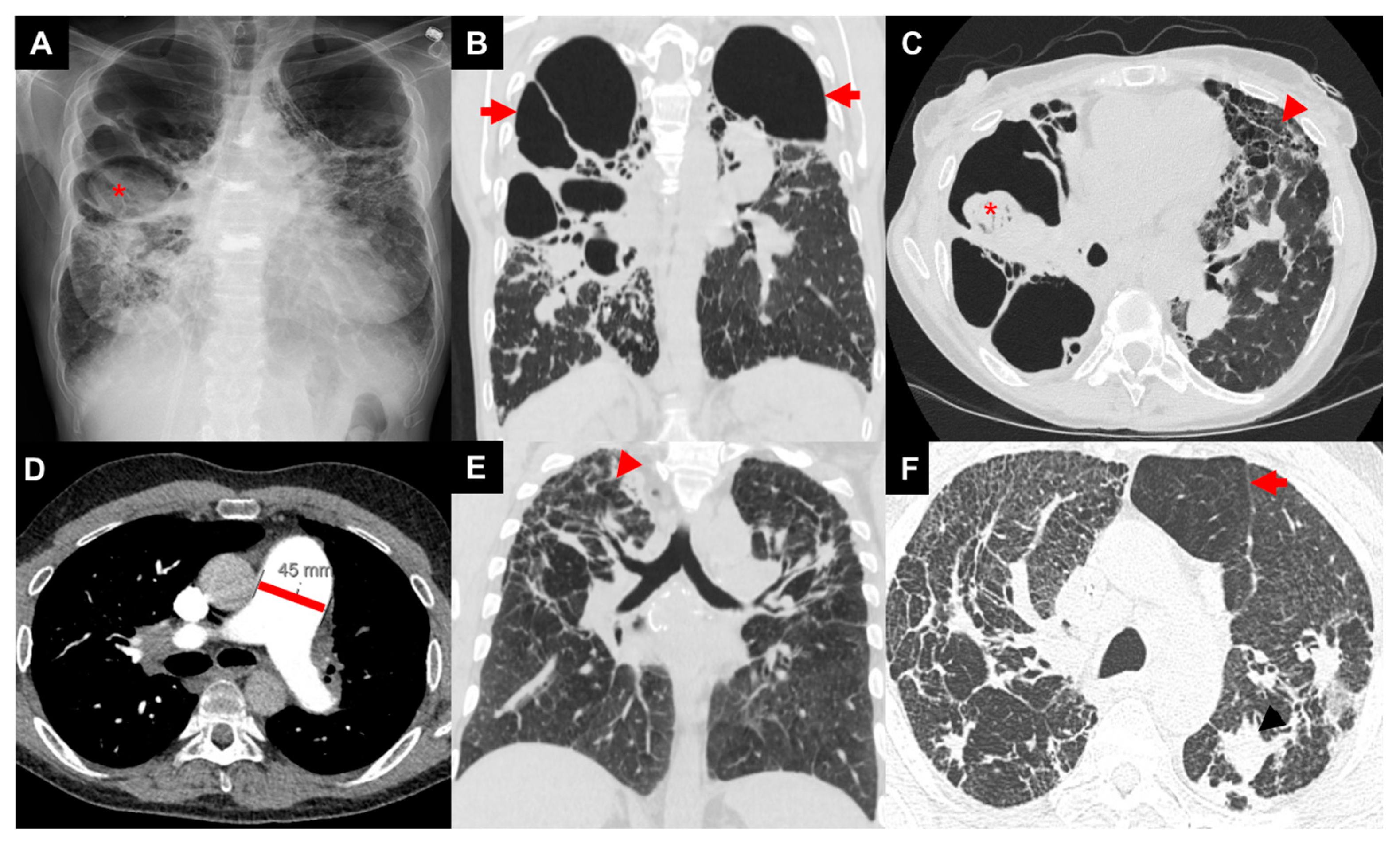 Jcm 13 00241 g002 Jcm 13 00241 g002